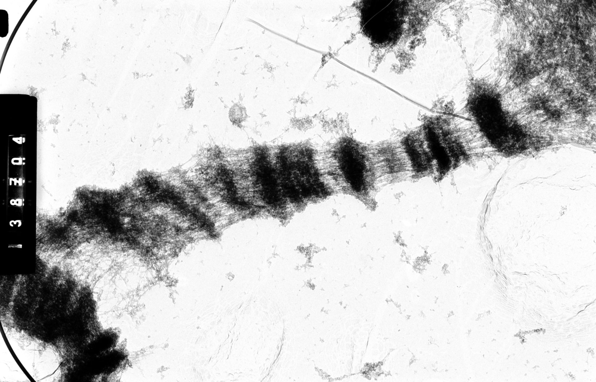 Drosophila melanocephala (Polytene chromosome) - CIL:35401