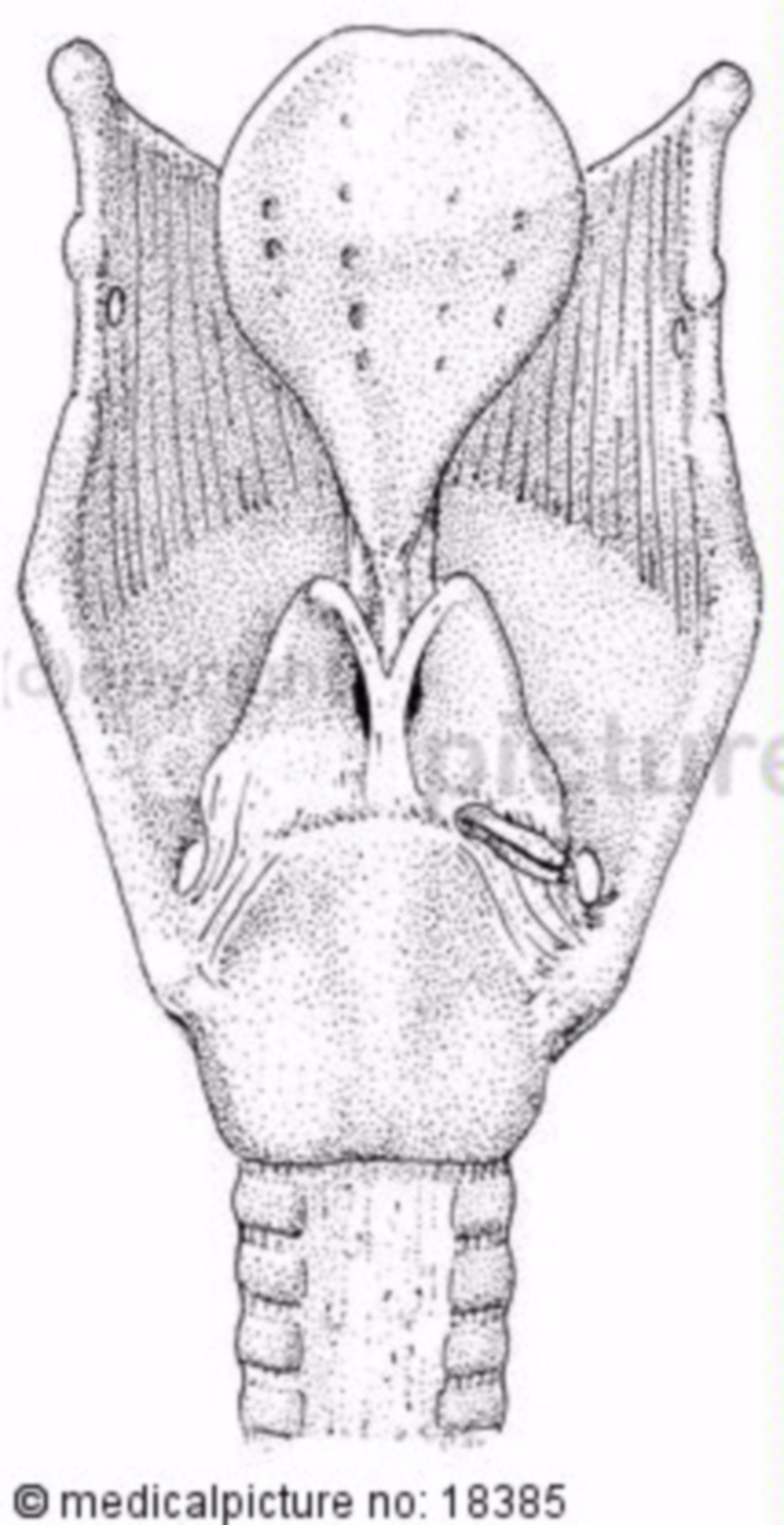  Kehlkopf, Larynx 
