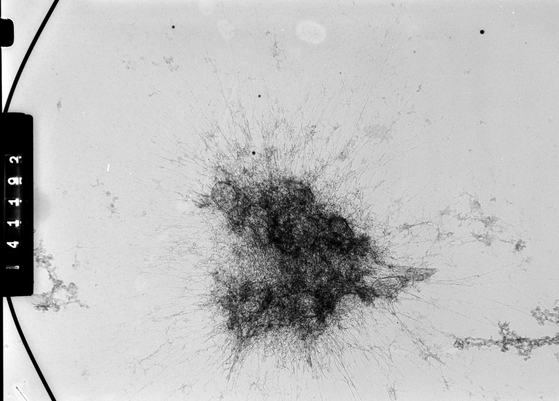 Homo sapiens (Condensed chromosome) - CIL:35383