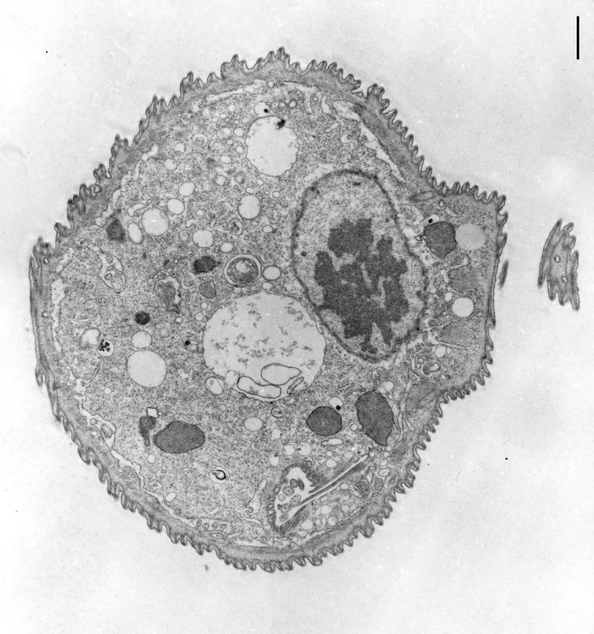 Opercularia coarctata (Cell cortex) - CIL:9923