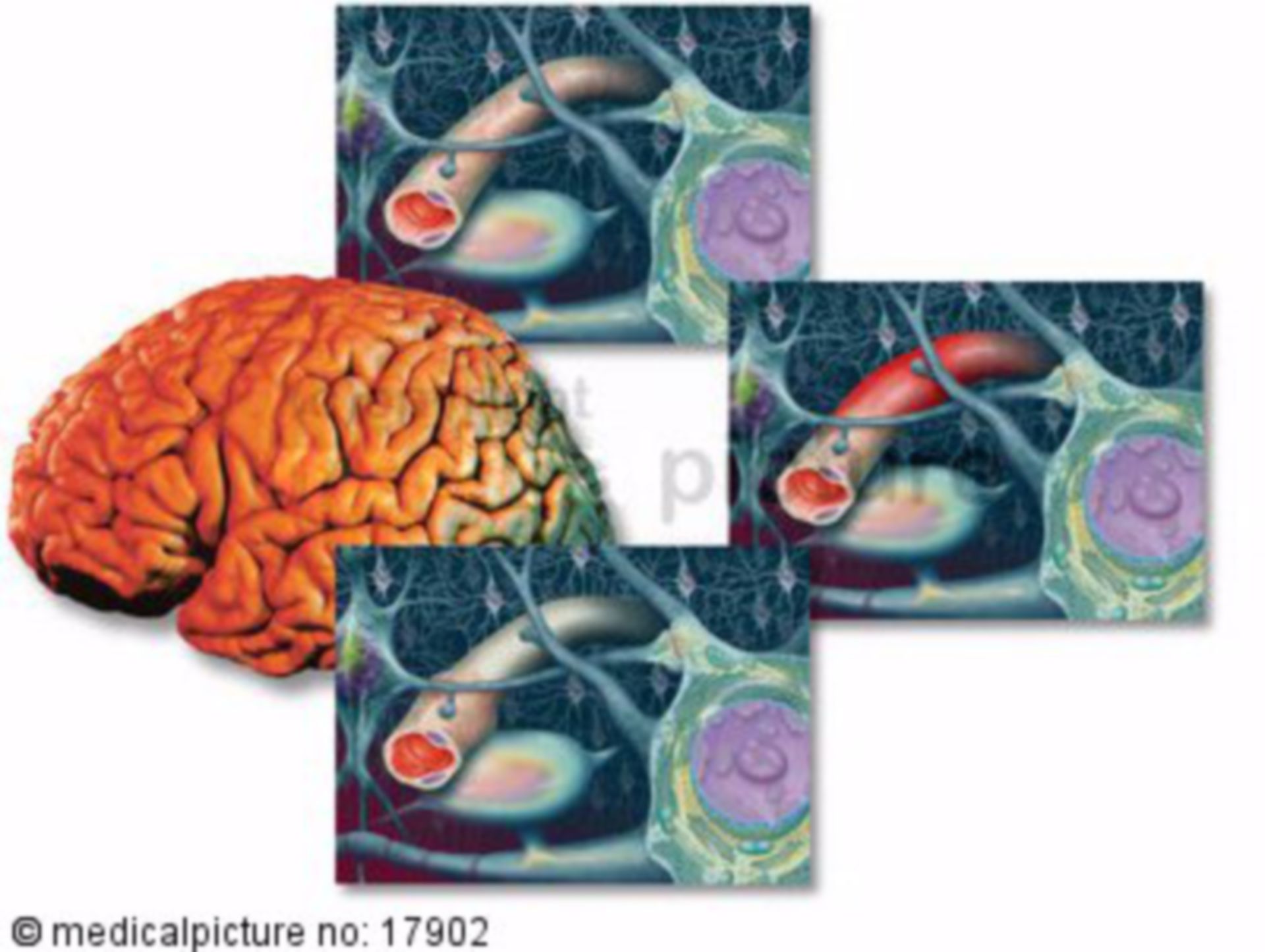 Migräne Gehirn