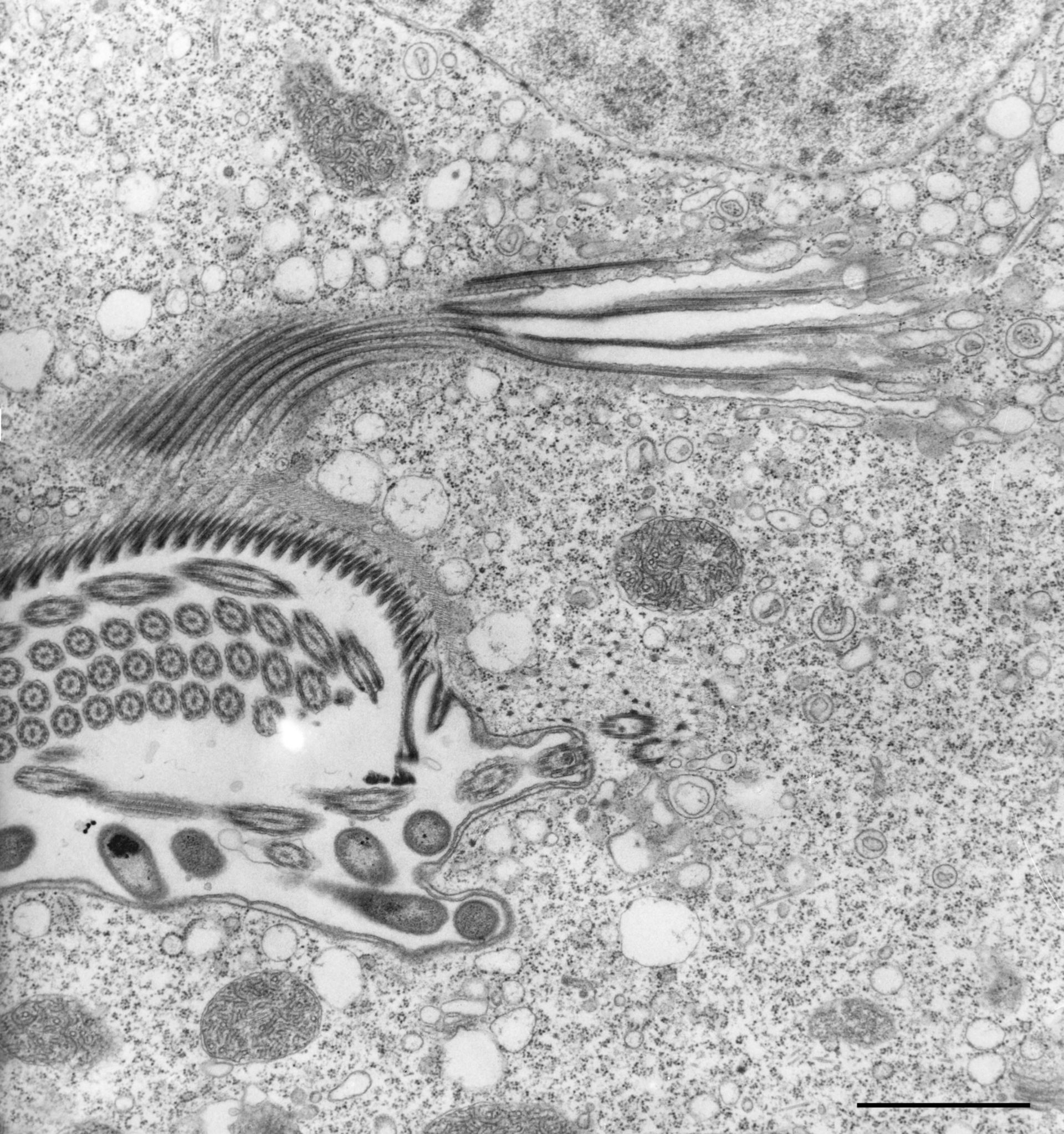 Vorticella convallaria (Cortical microtubule cytoskeleton) - CIL:36268