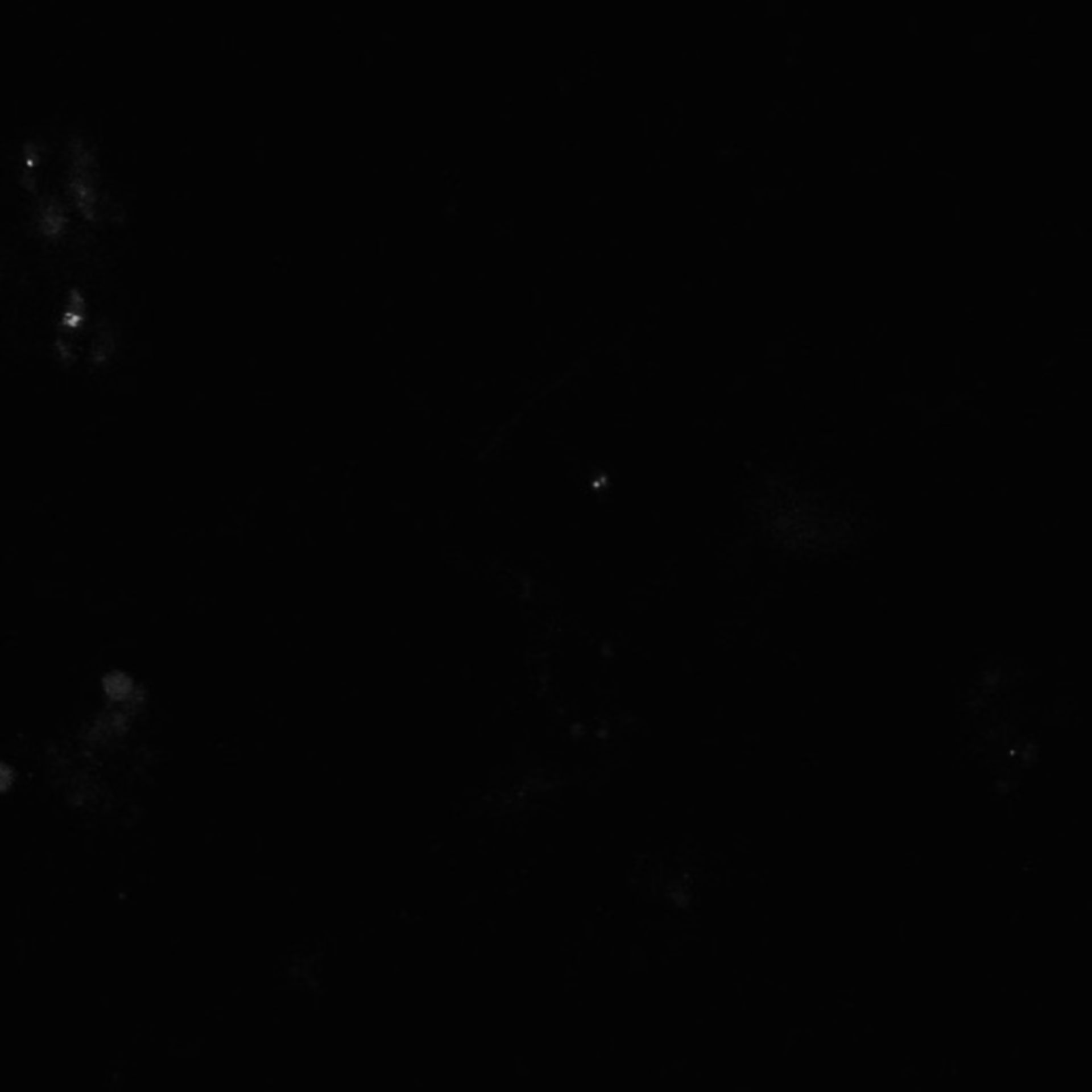 Xenopus laevis (Neuronal cell body) - CIL:36982