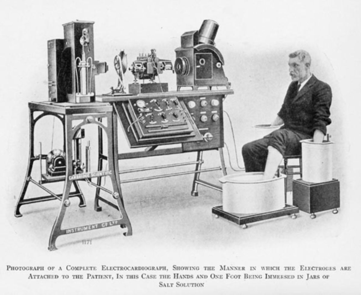 Historisches EKG (1911)