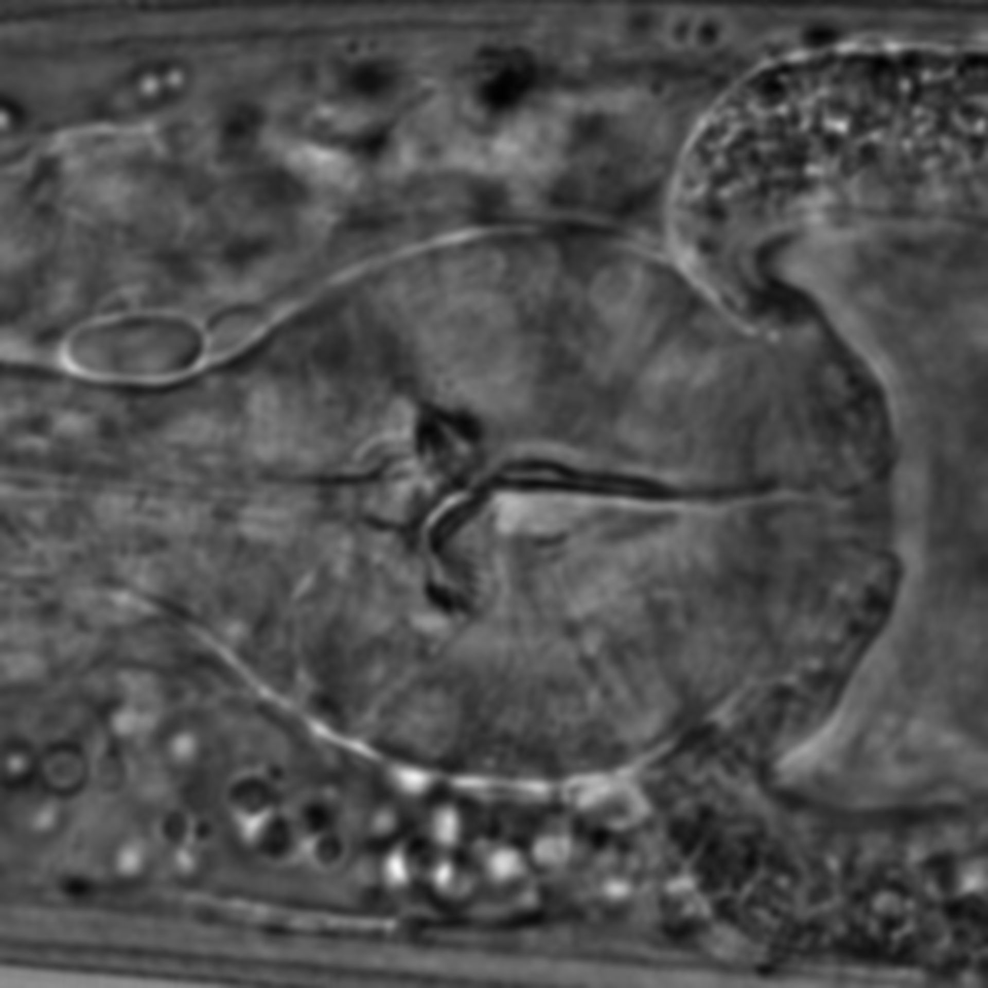 Caenorhabditis elegans - CIL:1623