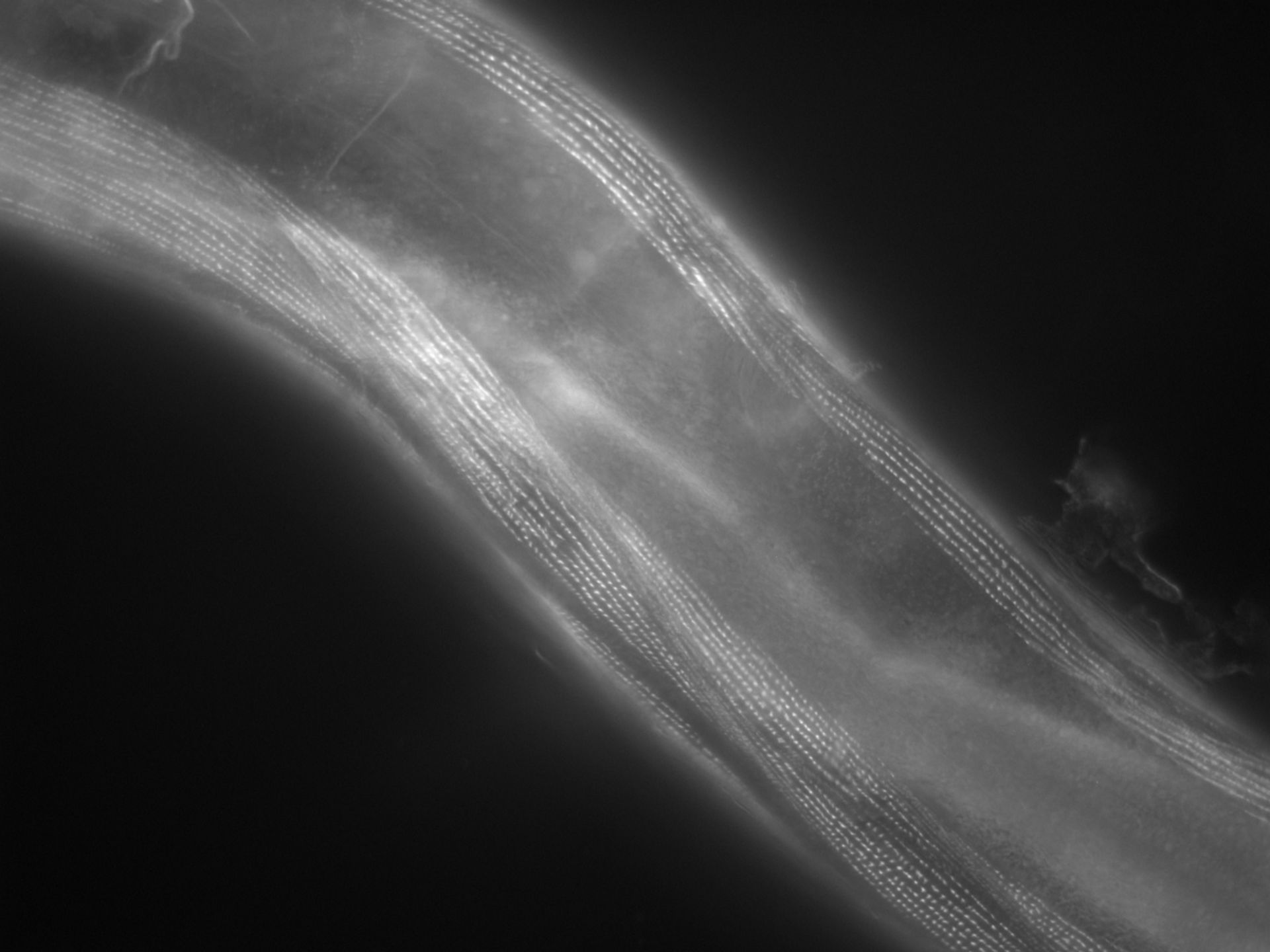 Caenorhabditis elegans (Actin filament) - CIL:1123