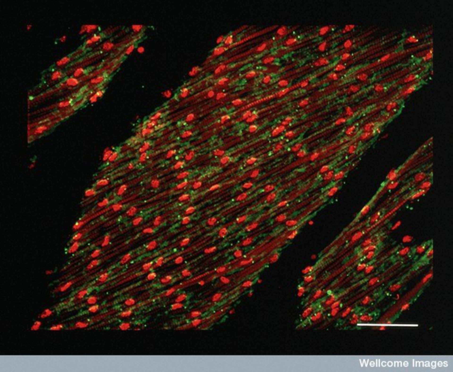 ... a Full Heart ... Image of the Week - January 14, 2019 - CIL:39011 - http://cellimagelibrary.org/images/39011