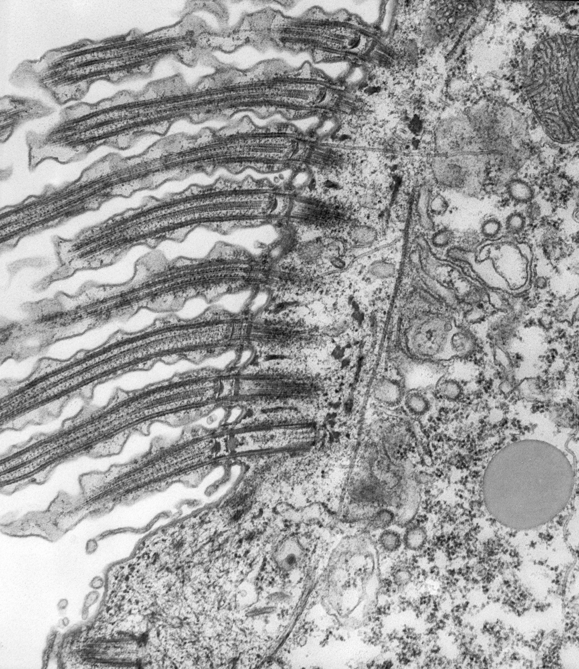 Paramecium caudatum (Glycogen granule) - CIL:39129
