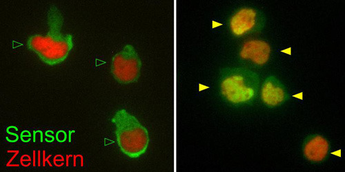 Abb. 1: Die Abbildung zeigt T-Lymphozyten mit Leuchtsensoren. Das grün-leuchtende Signal des Sensors wandert bei Aktivierung des T-Lymphozyten (hier pharmakologische Aktivierung durch Ionomycin) in den Zellkern (links, grüne Pfeile: ruhende T-Lymphozyten; rechts, gelbe Pfeile: aktivierte Lymphozyten).