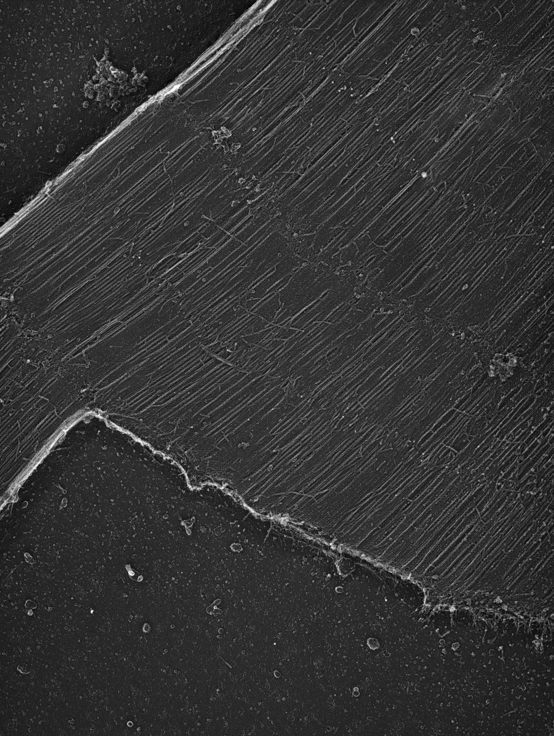 Damselfly (Sarcoplasmic reticulum) - CIL:36094