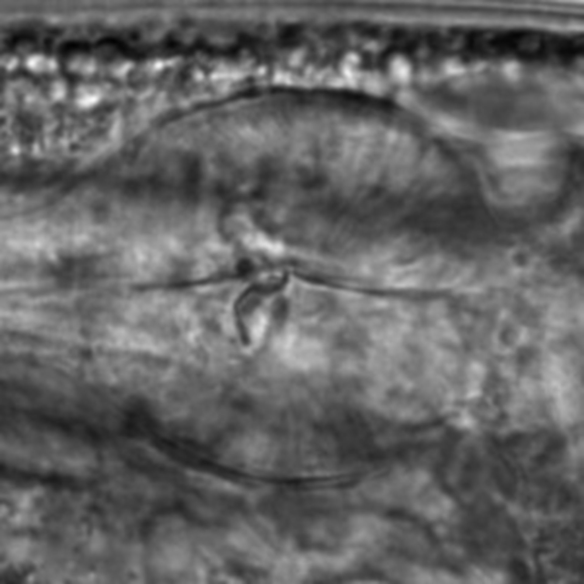 Caenorhabditis elegans - CIL:2197