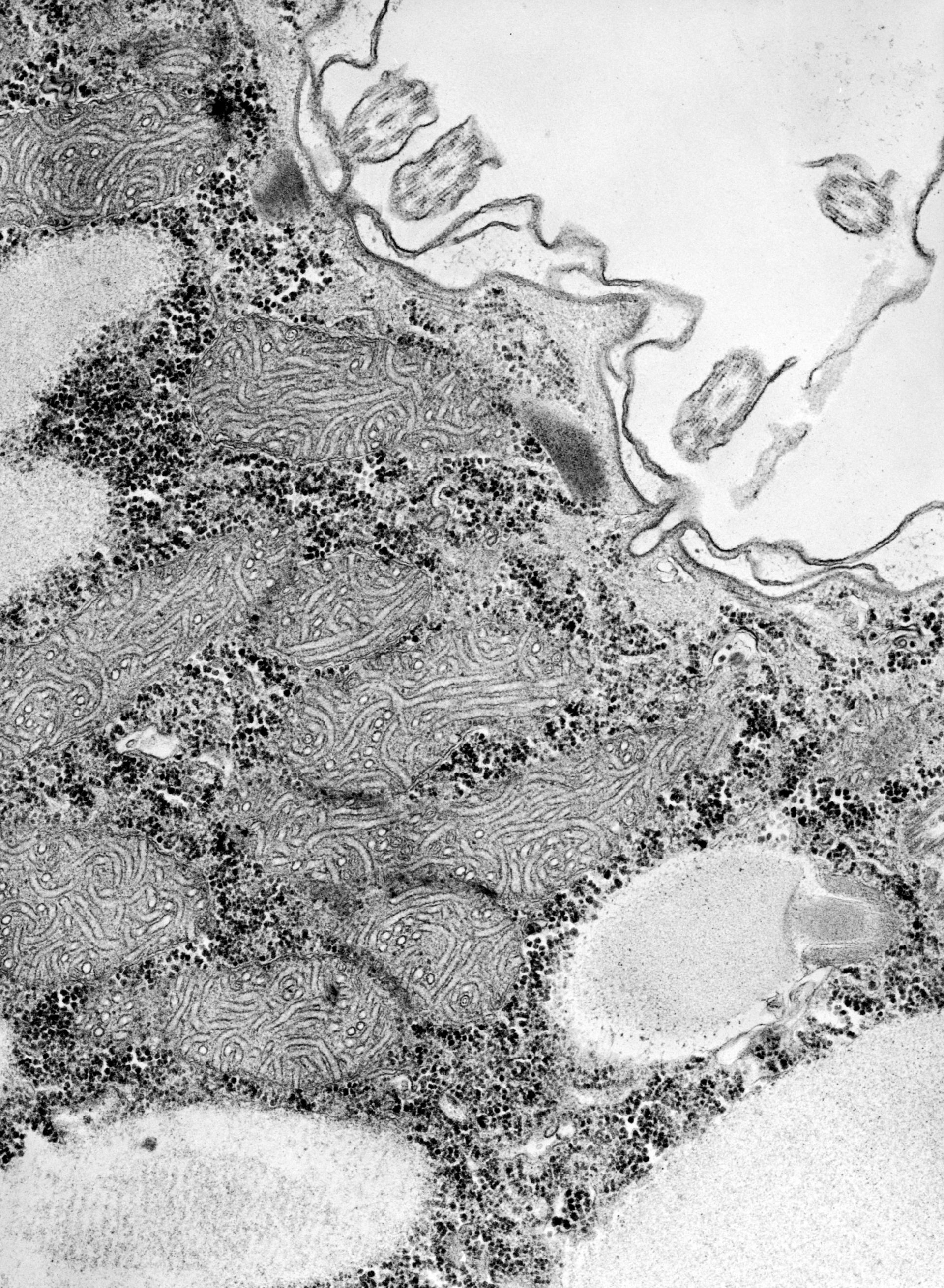 Paramecium caudatum (Glycogen granule) - CIL:39127