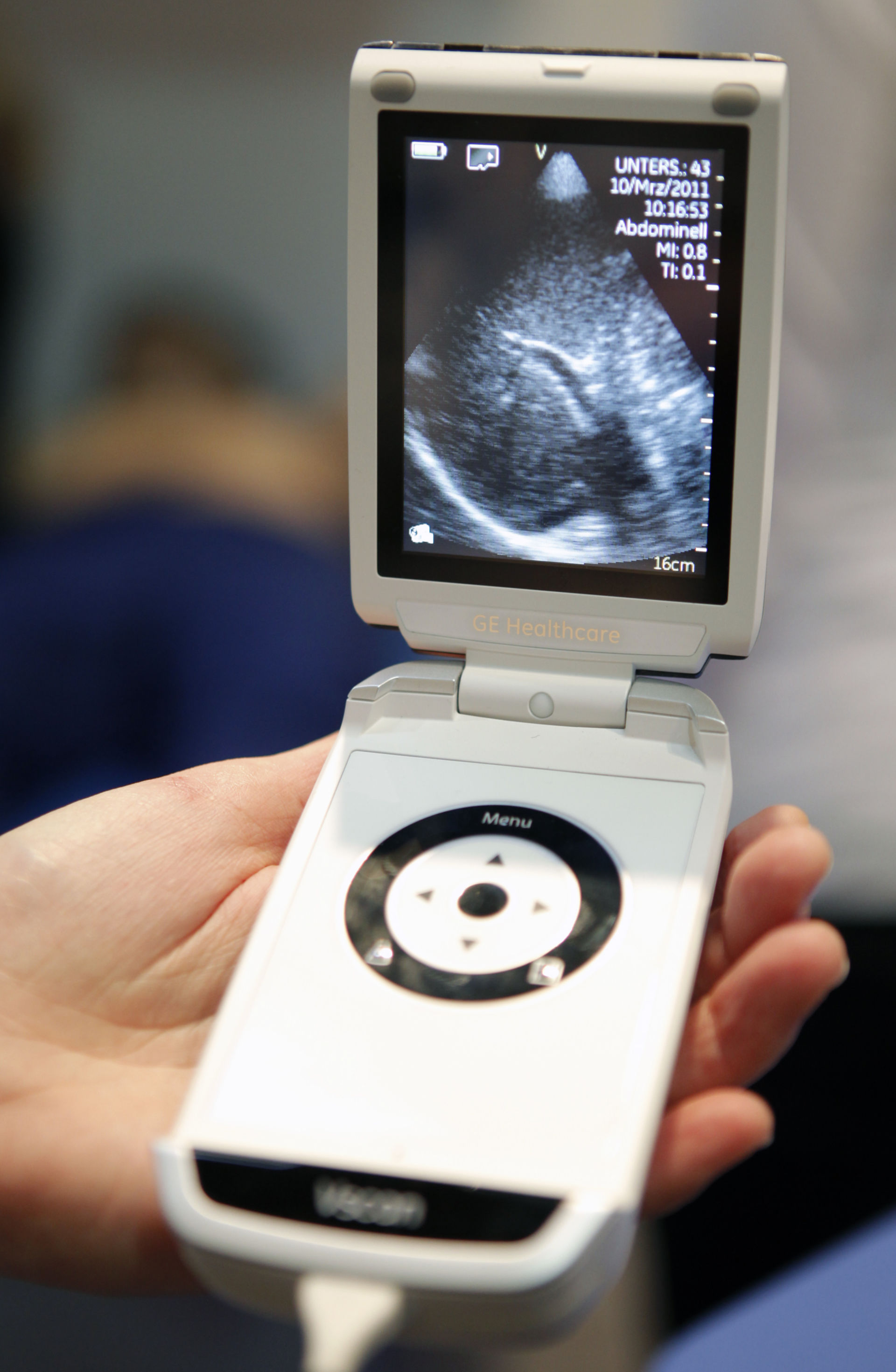 Mini ultrasonography device