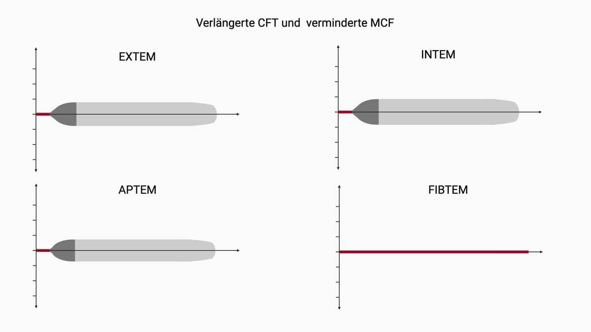 Rotationsthrombelastometrie (ROTEM®)