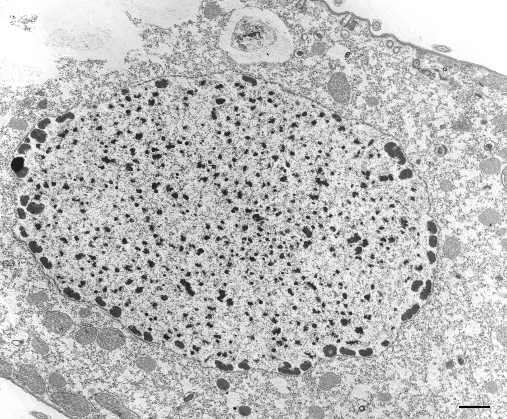 Tetrahymena pyriformis (Nucleolus) - CIL:34615