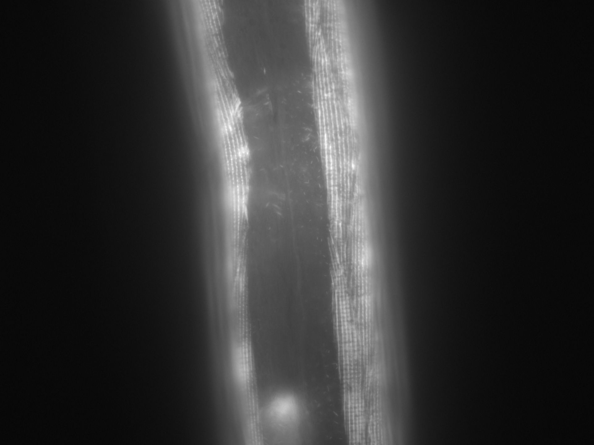 Caenorhabditis elegans (Actin filament) - CIL:1007