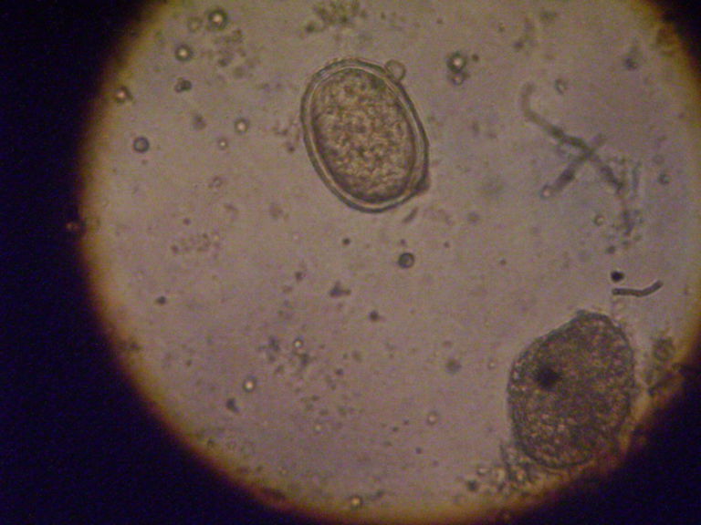 Ascaris Lumbricoides Doccheck