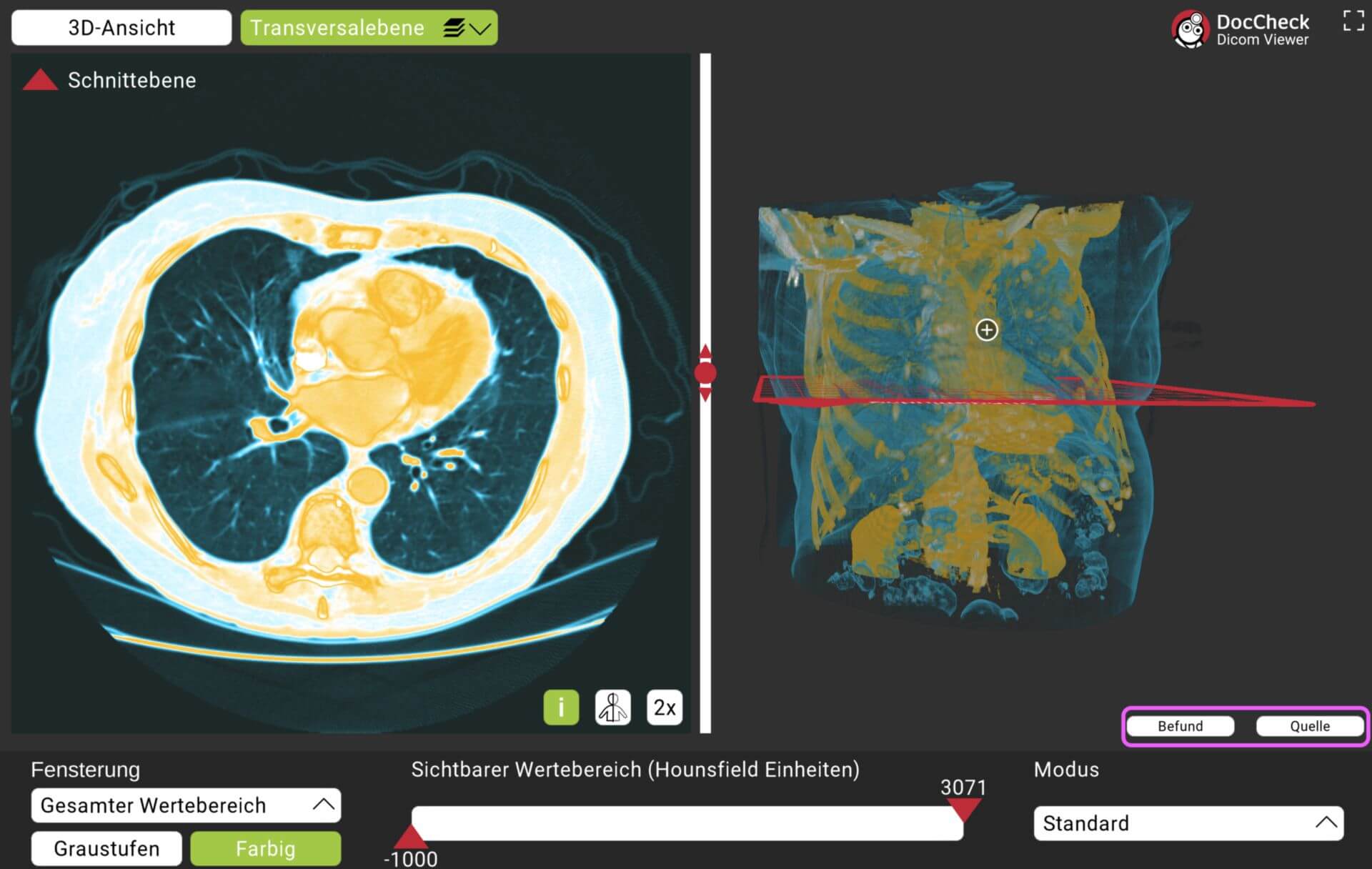 DICOM-Viewer: Befund und Quelle