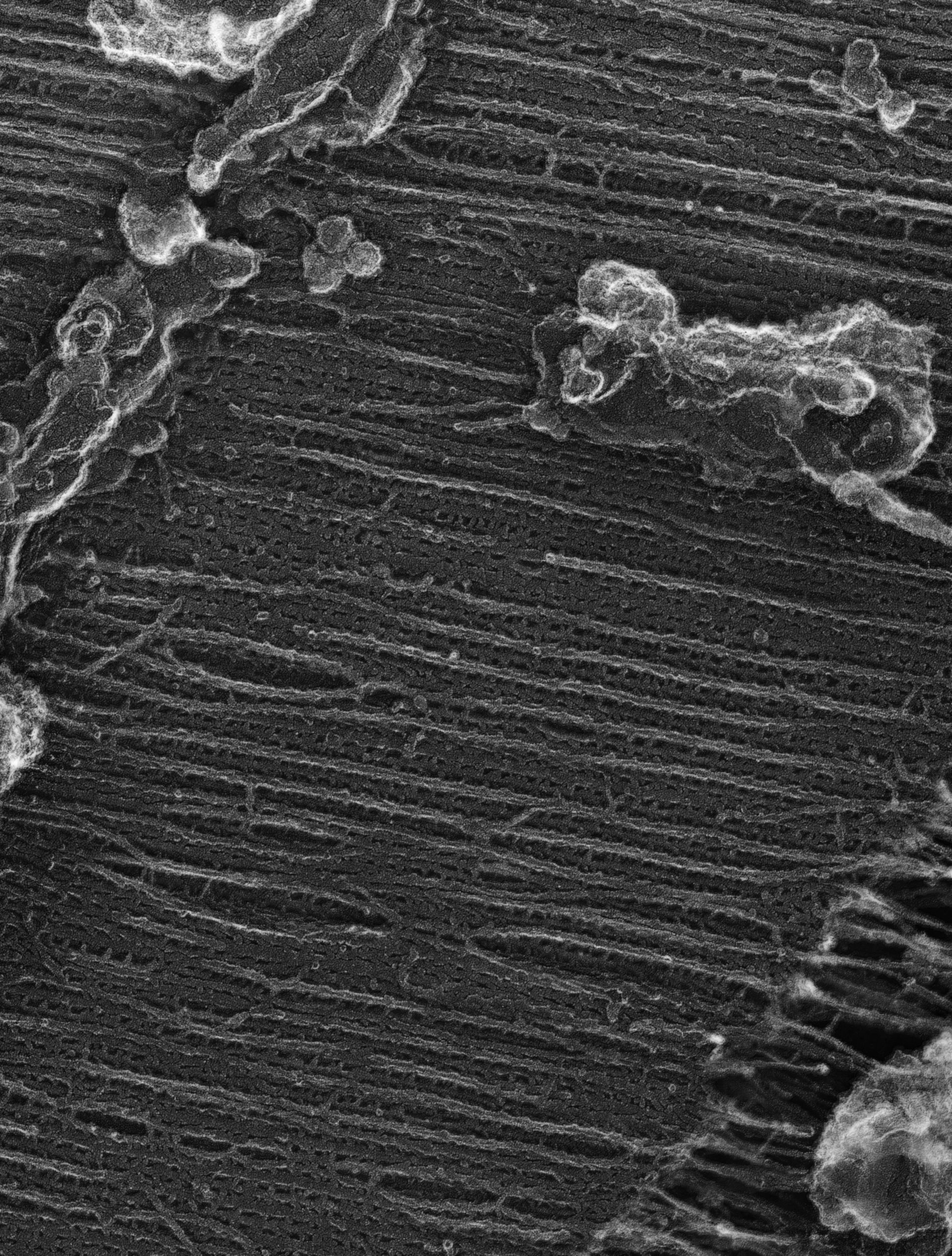Damselfly (Sarcoplasmic reticulum) - CIL:36095