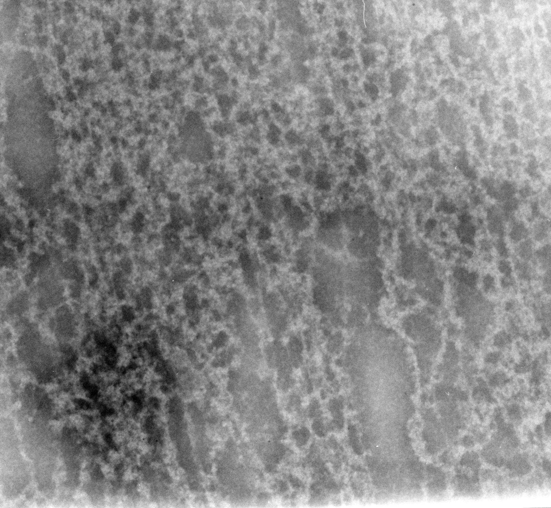 Notopthalmus viridescens (Nuclear chromatin) - CIL:9976