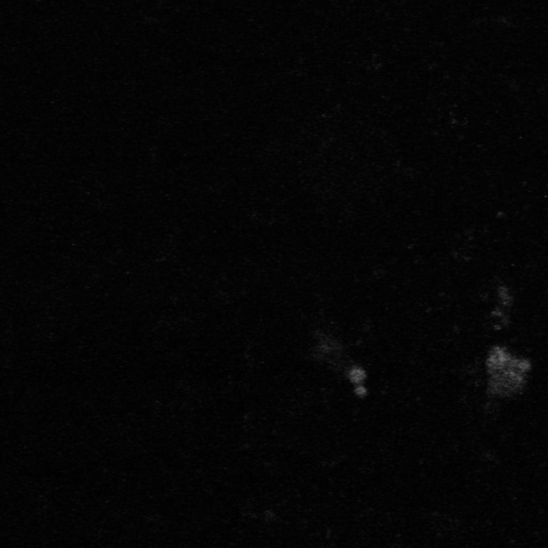 Xenopus laevis (Neuronal cell body) - CIL:37070