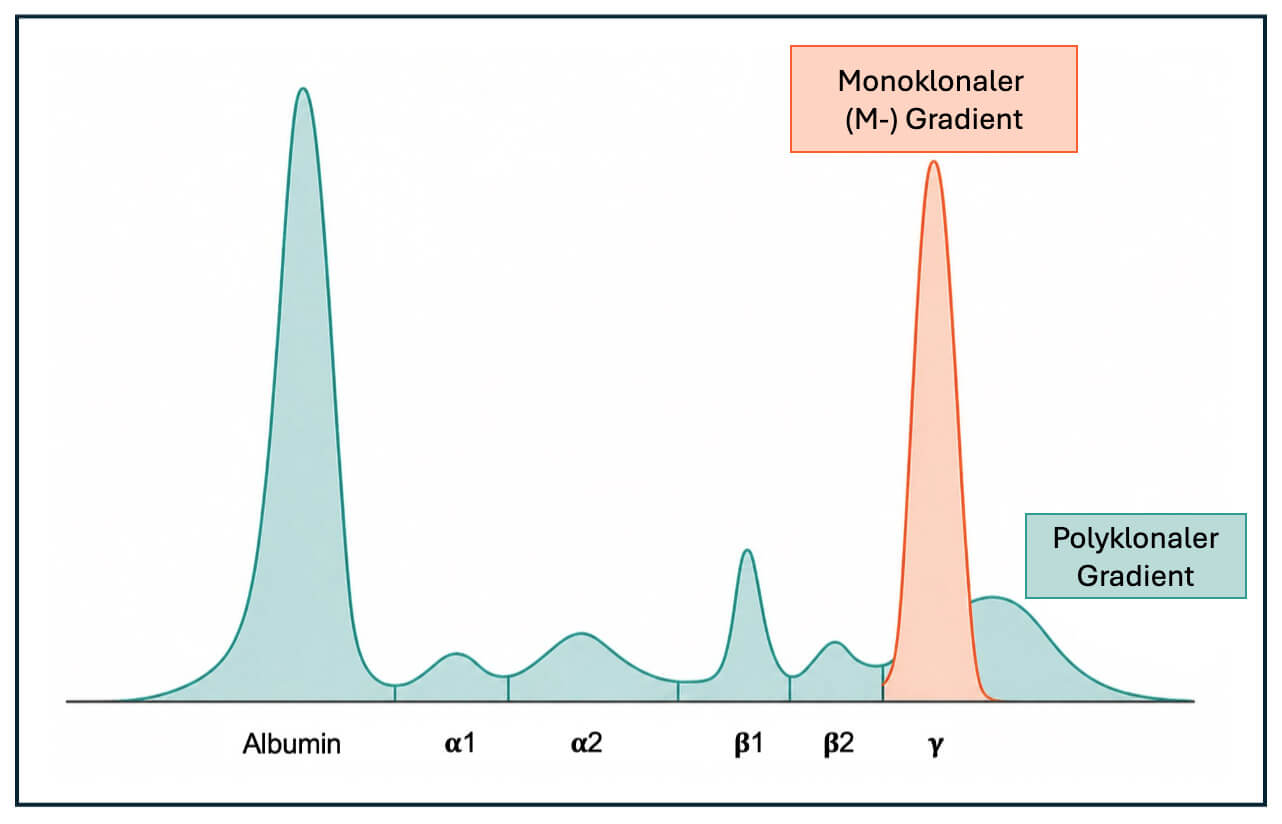 Drei Tests, ein Ziel: MG sicher diagnostizieren mit SPE, IFE und FLC ...