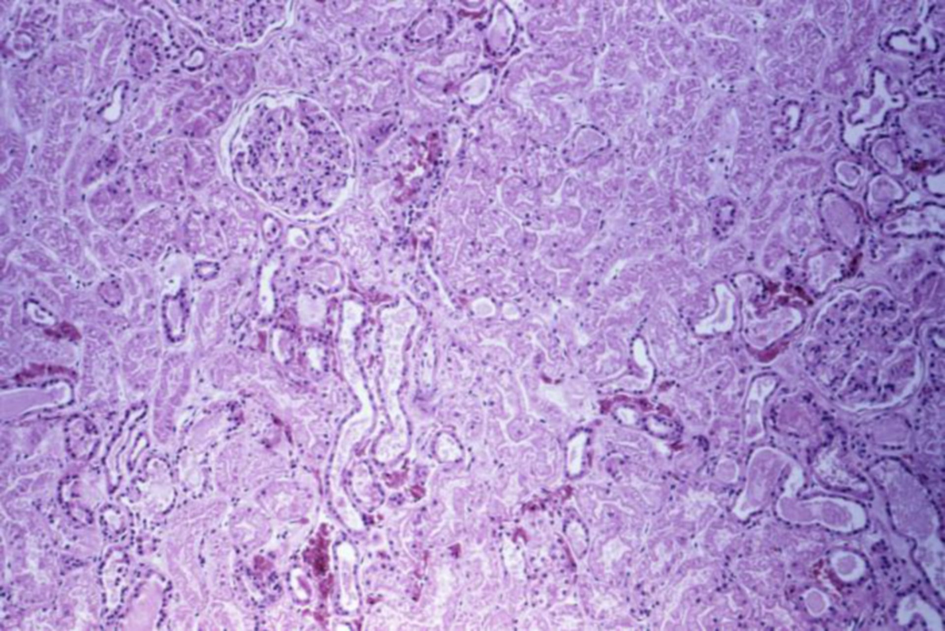 Marburg-Virus: Pathologie Niere