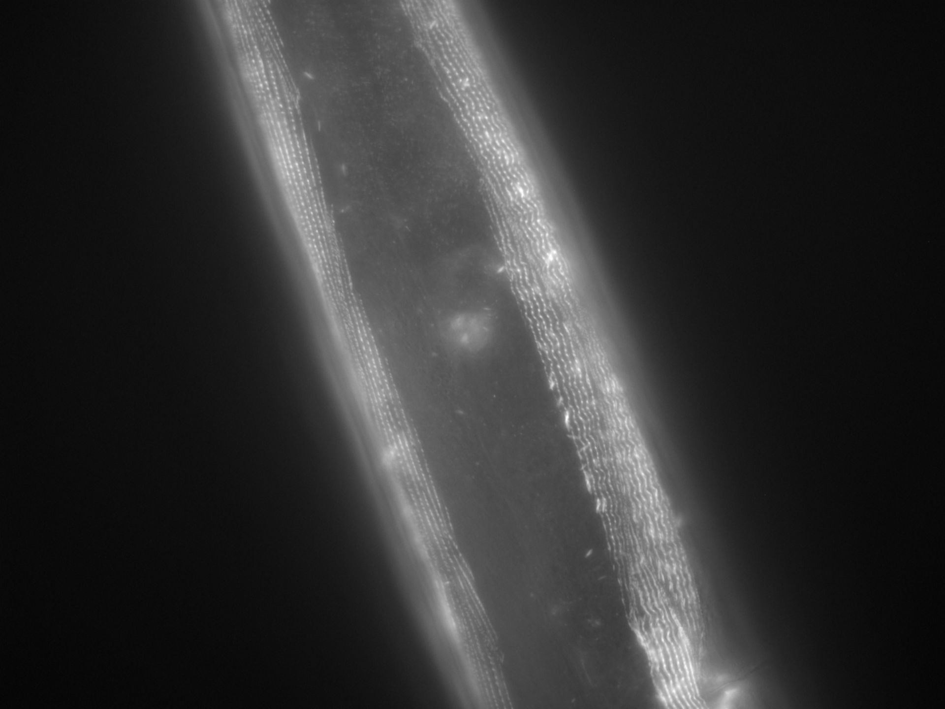 Caenorhabditis elegans (Actin filament) - CIL:1042