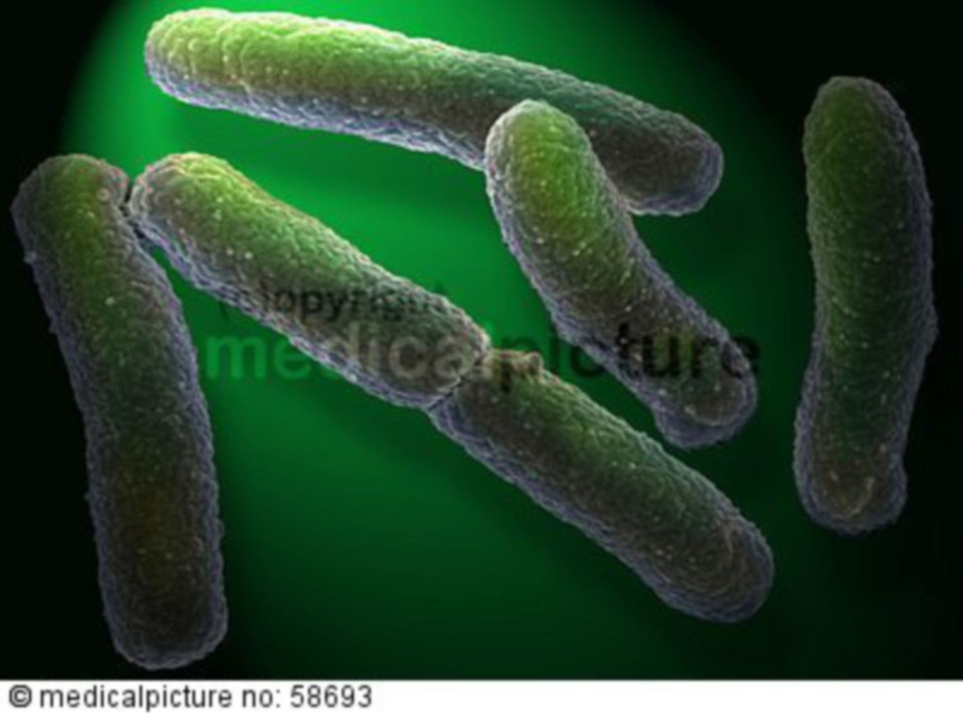 NDM 1-Bakterium