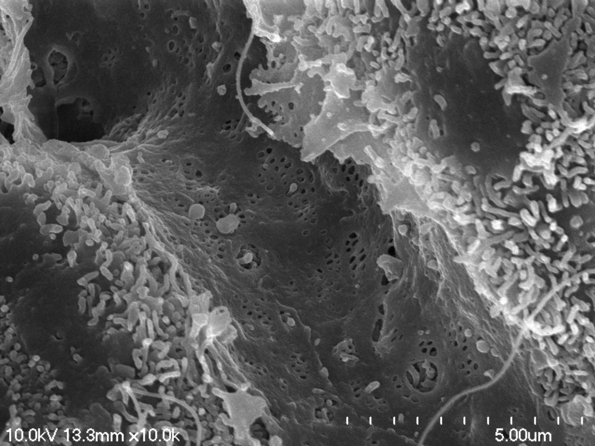Rattus norvegicus (Blood vessel endothelial cell) - CIL:35464