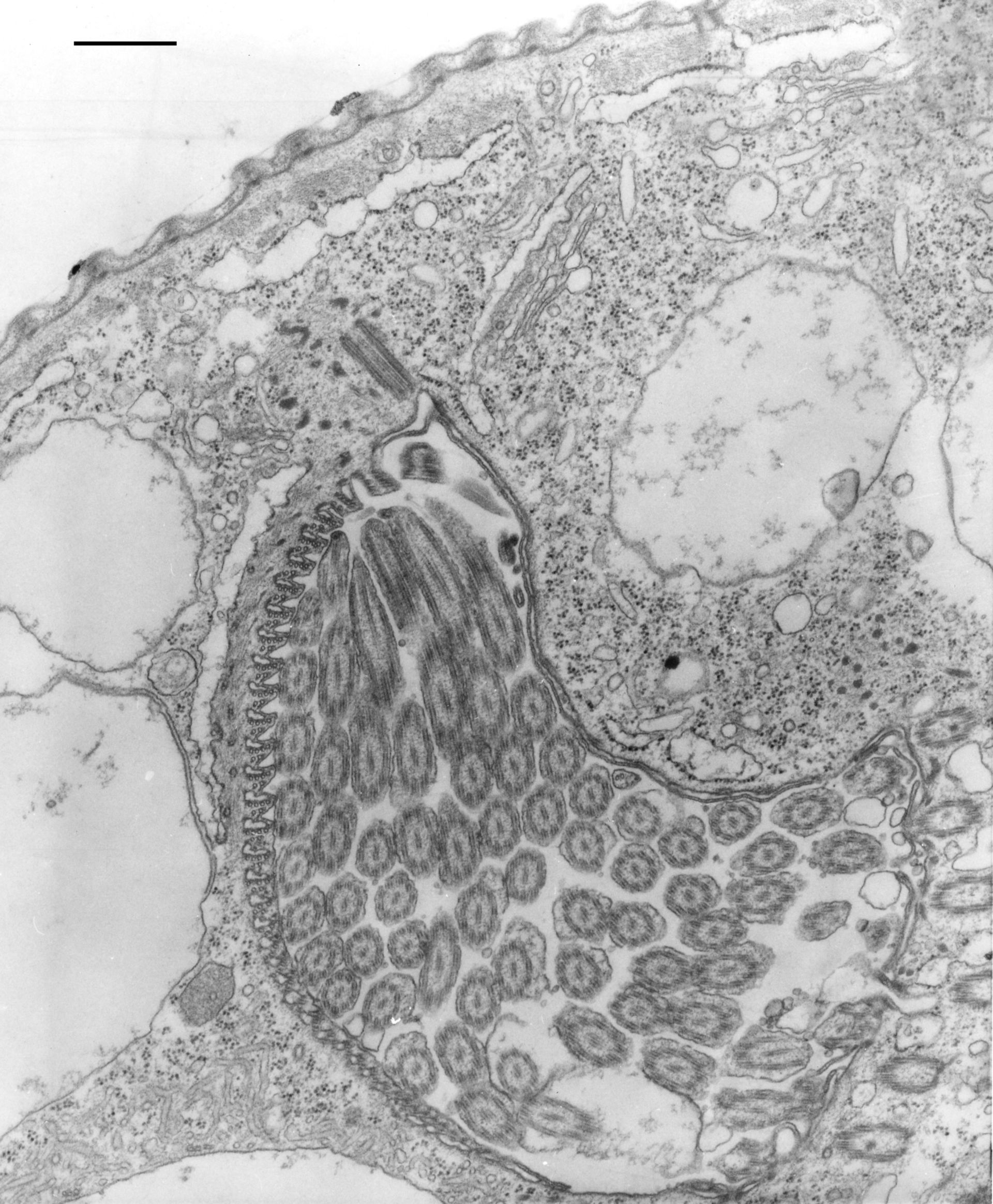 Opercularia coarctata (Microtubule basal body) - CIL:9922