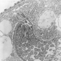 Intrazellulär DocCheck Flexikon