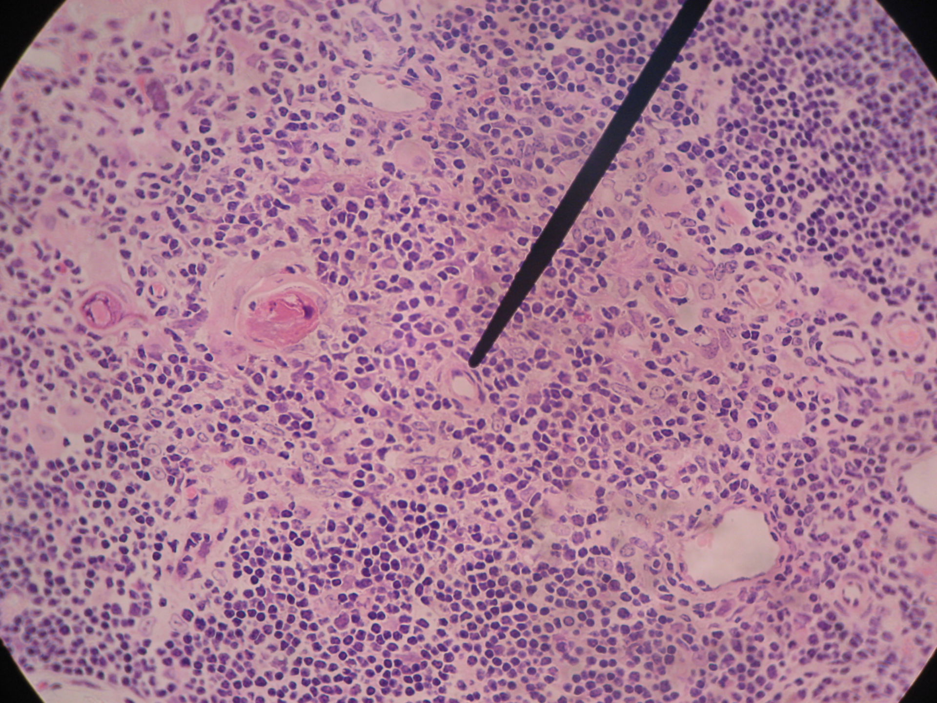 Thymus gland of a sheep 3 - capillary, Hassall-bodies, macrophages, T-cells, eosinophil-degenerated epithelium cells