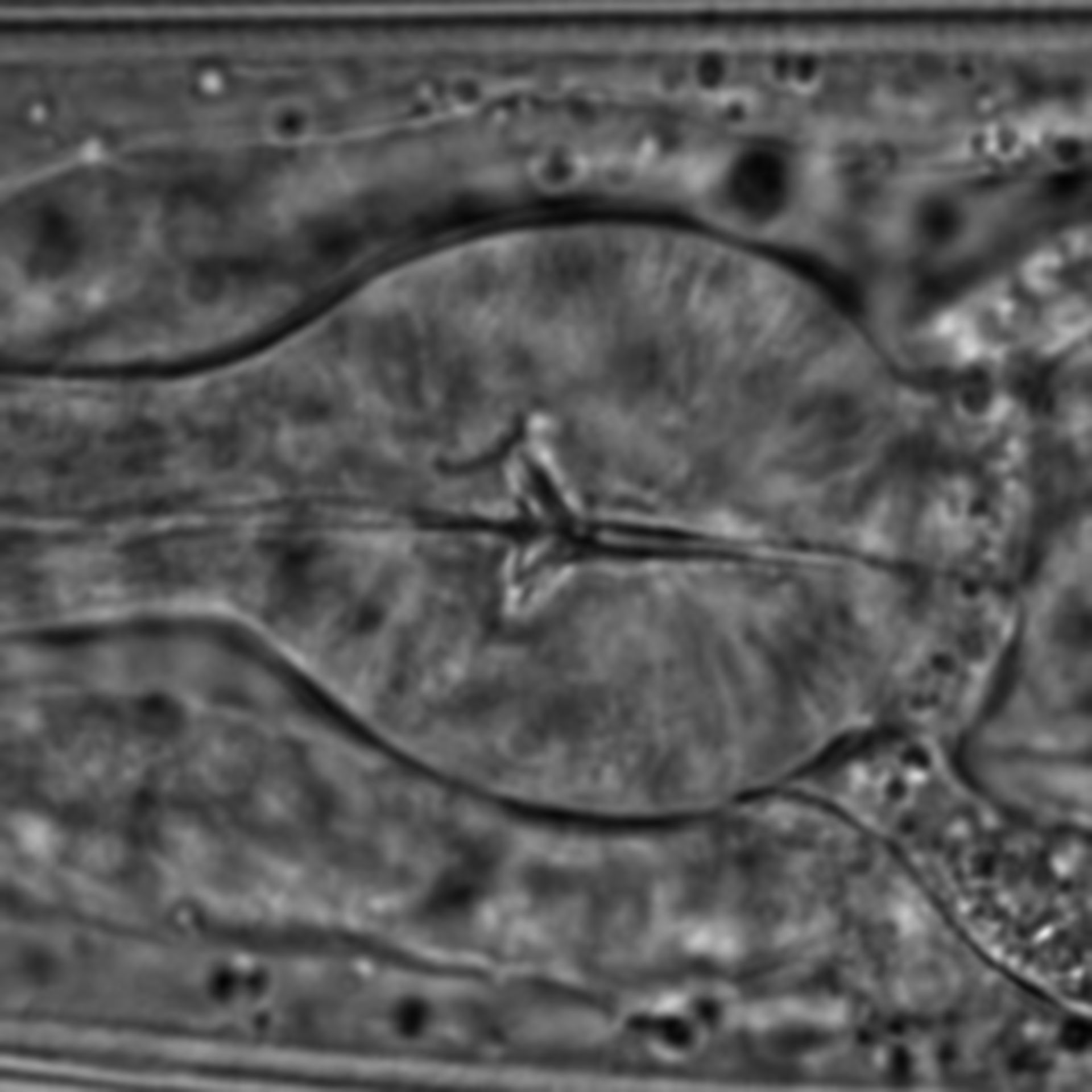 Caenorhabditis elegans - CIL:1593