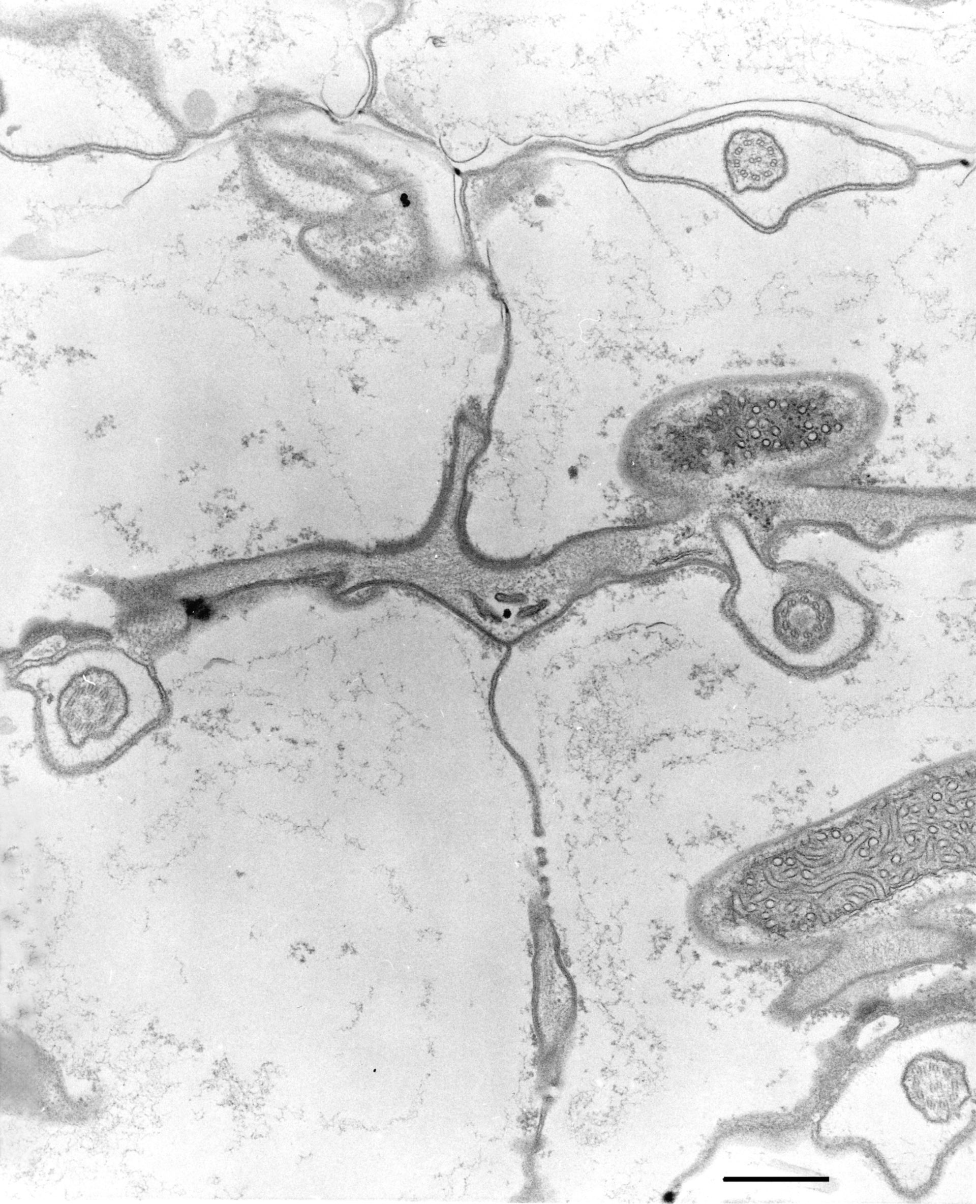 Coleps hirtus (Axonemal dynein complex) - CIL:9696