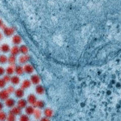 Inokulation - DocCheck Flexikon