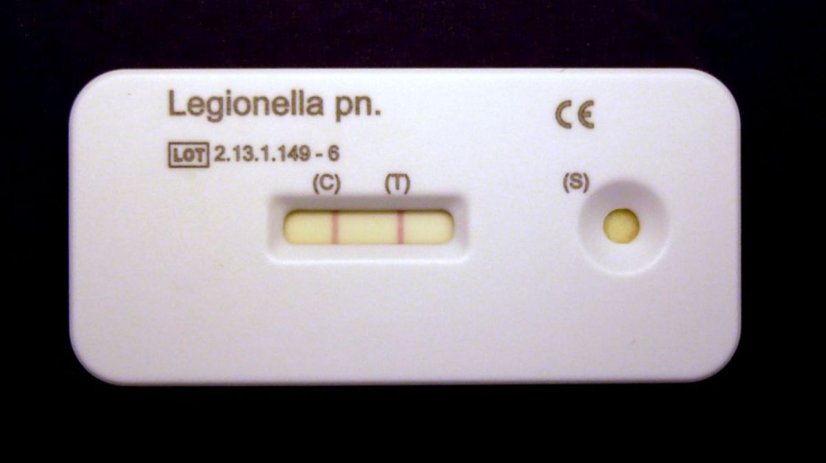 Legionellen-Antigen im Urin