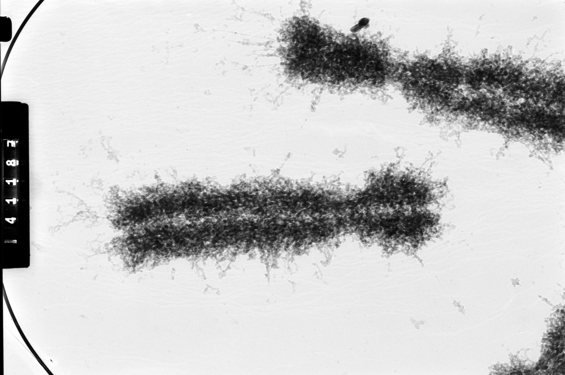 Homo sapiens (Condensed chromosome) - CIL:35380