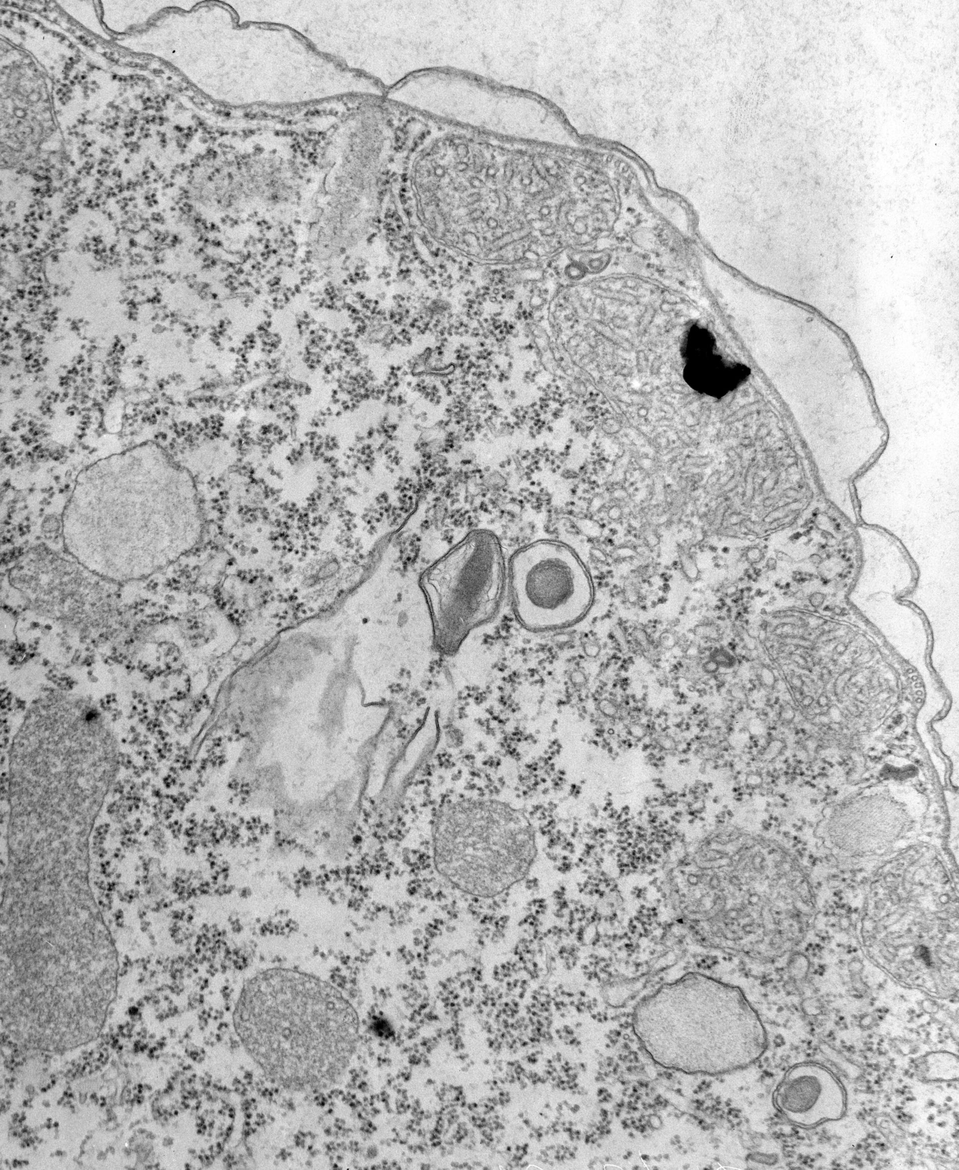 Tetrahymena pyriformis (Cell cortex) - CIL:39723