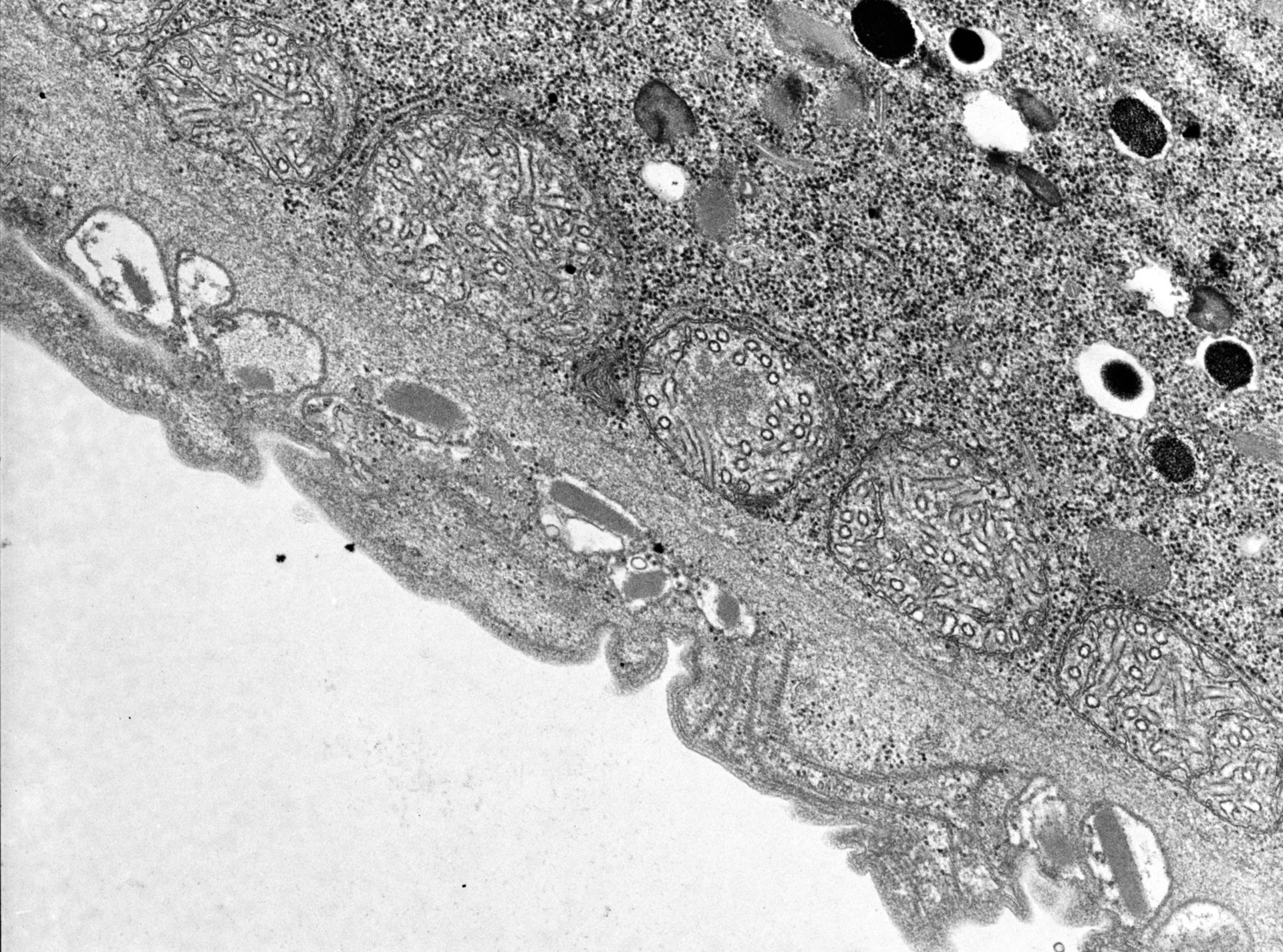 Didinium nasutum (Extrusomes) - CIL:9928