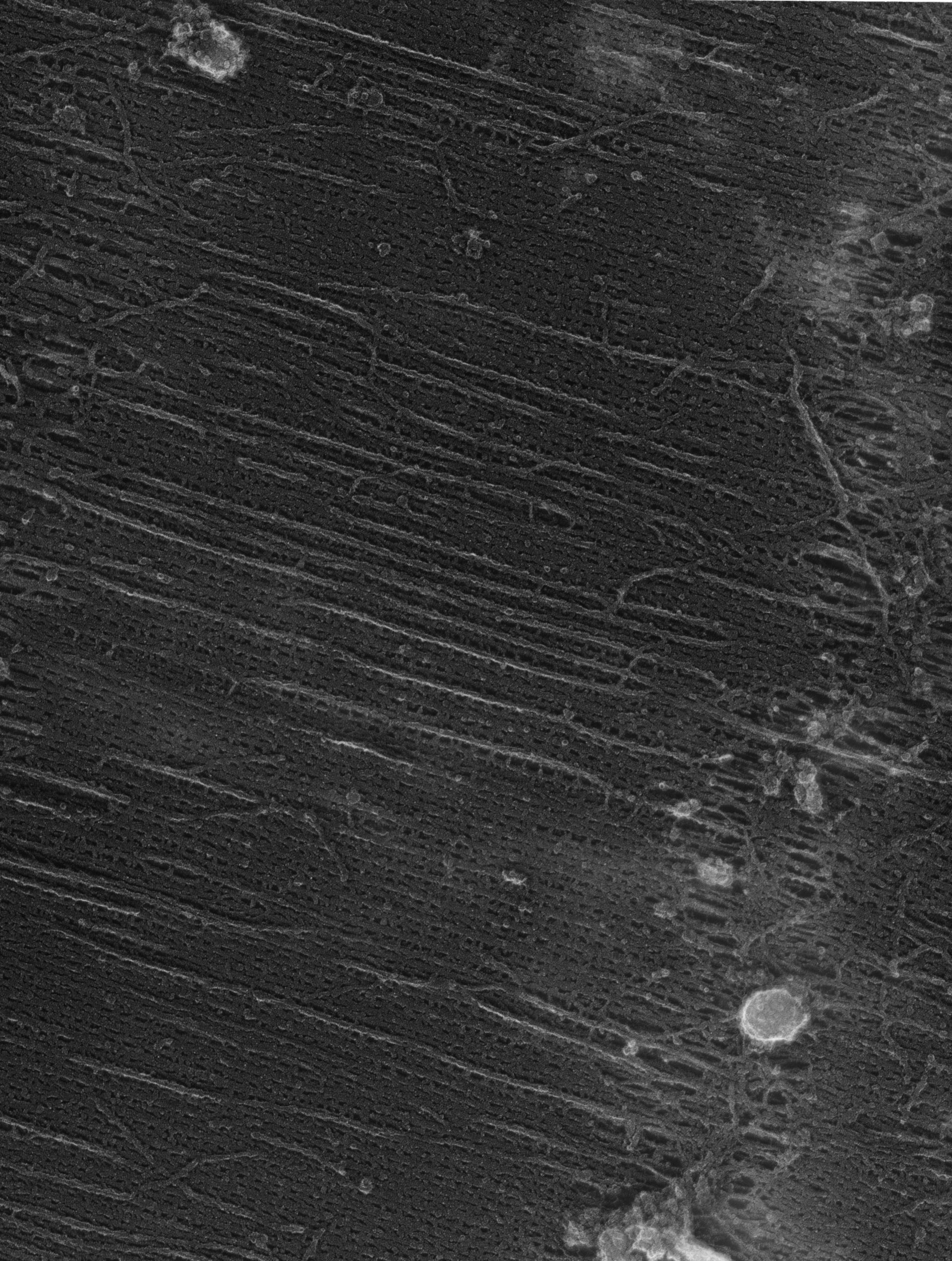 Damselfly (Sarcoplasmic reticulum) - CIL:36103