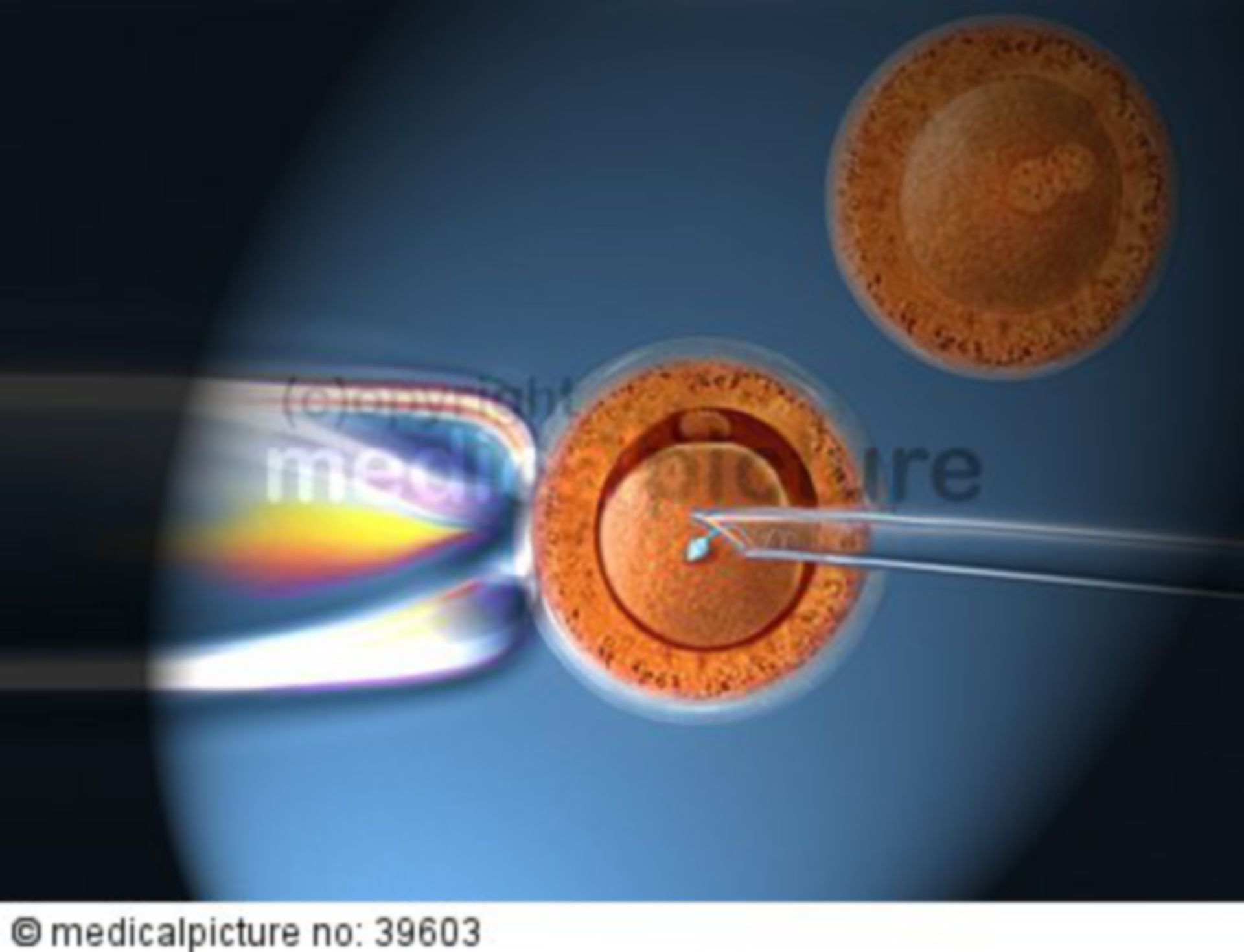  In-vitro-Fertilisation 
