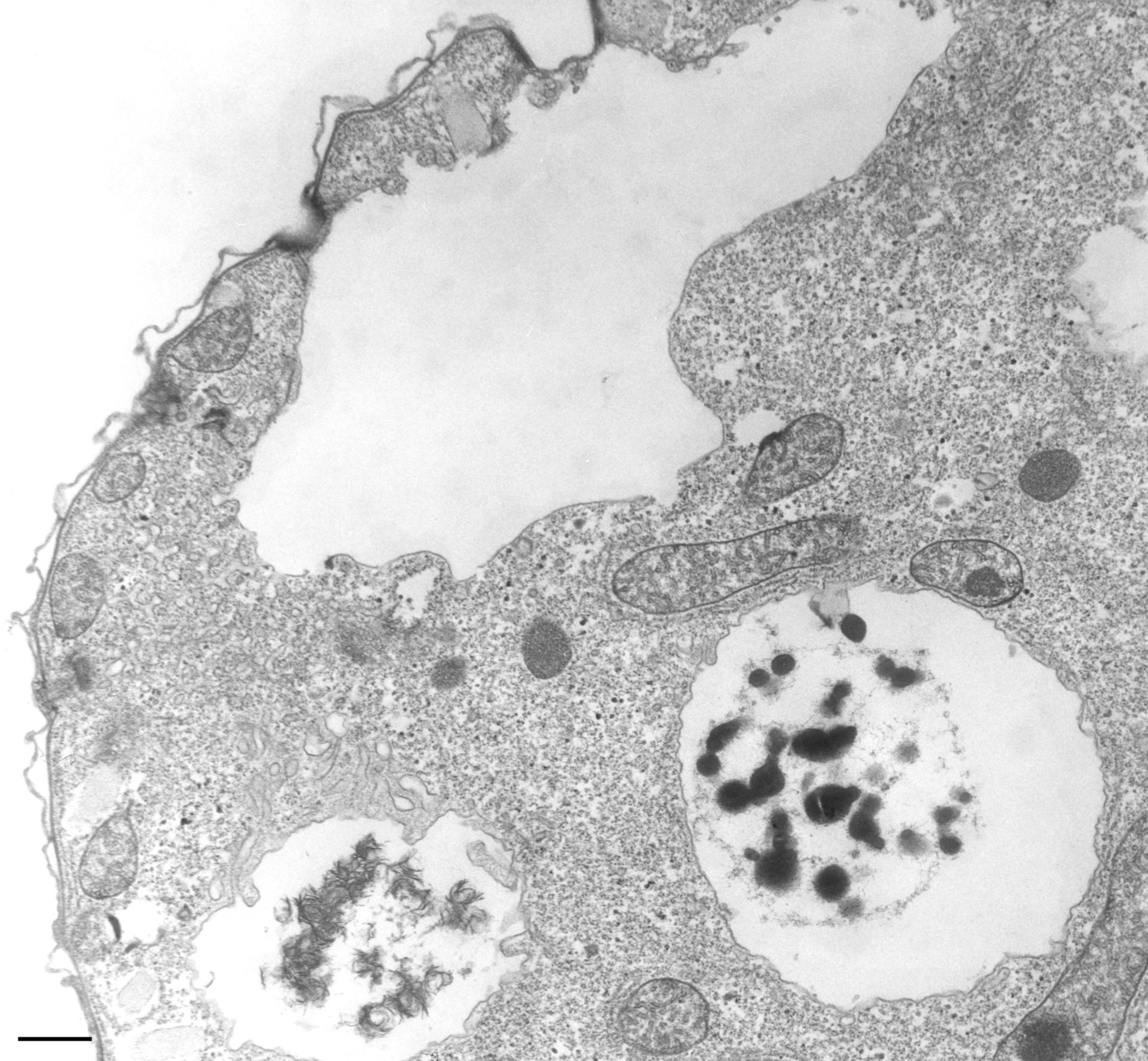 Tetrahymena pyriformis (Food vacuole) - CIL:36234 - DocCheck