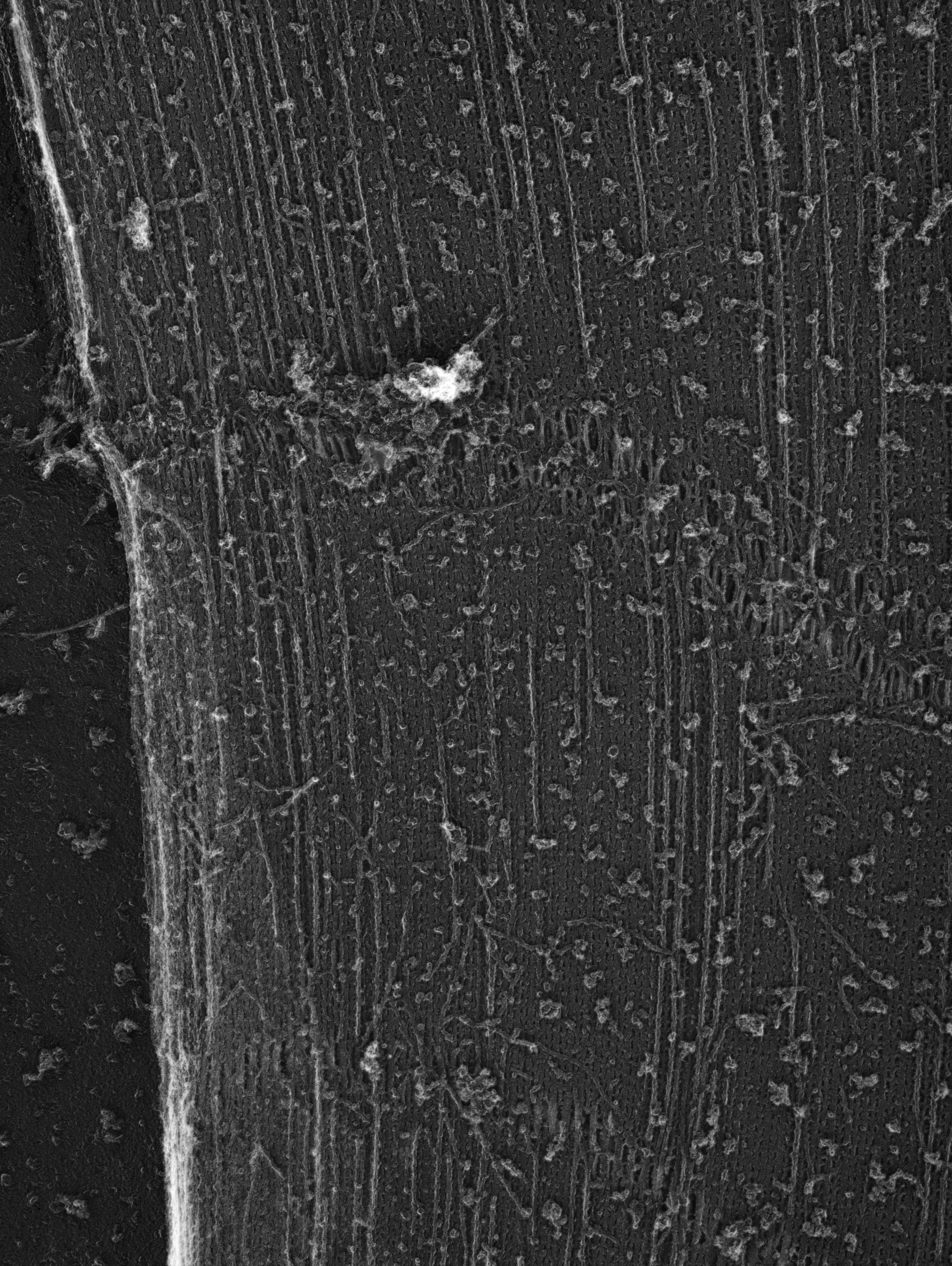 Damselfly (Sarcoplasmic reticulum) - CIL:36093
