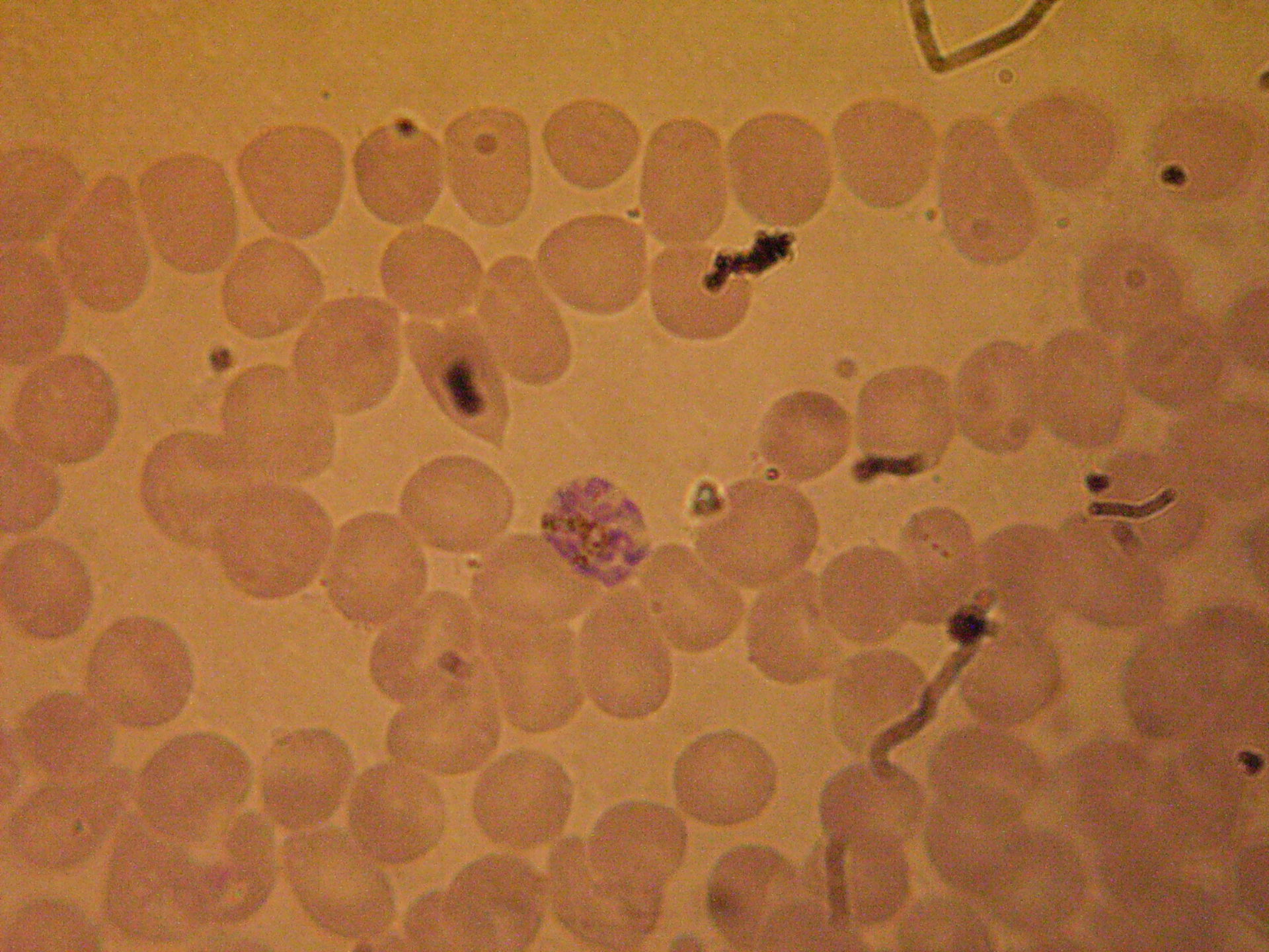 Plasmodium malariae rosettenform b