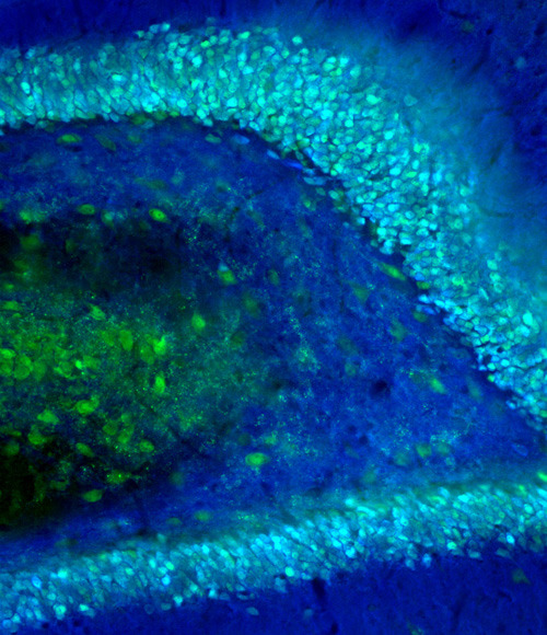 Körnerzellen im Gyrus dentatus einer Ratte, durch Fluoreszenzmikroskopie sichtbar gemacht (in Cyanblau). © Burgalossi Lab