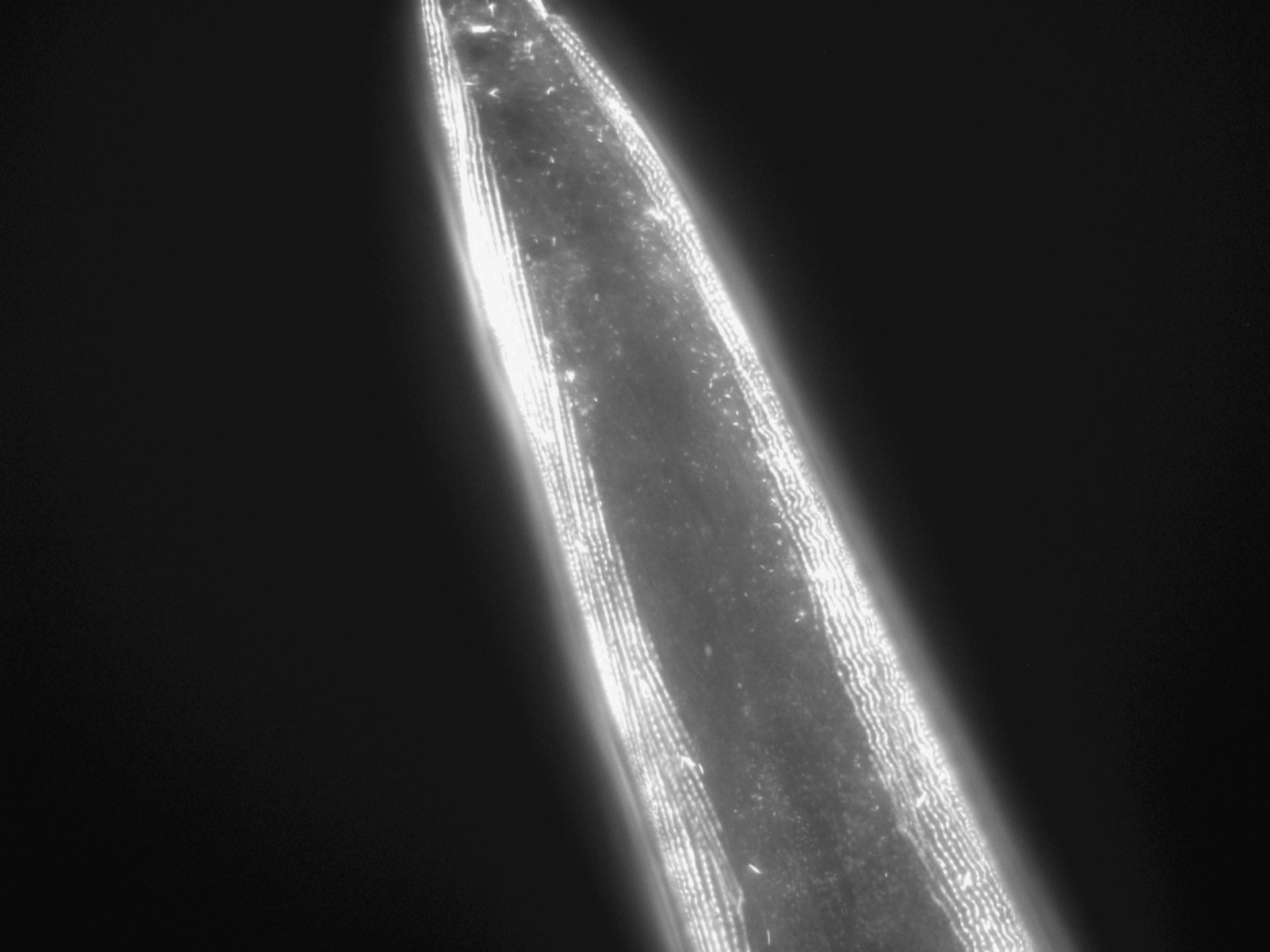 Caenorhabditis elegans (Actin filament) - CIL:1043