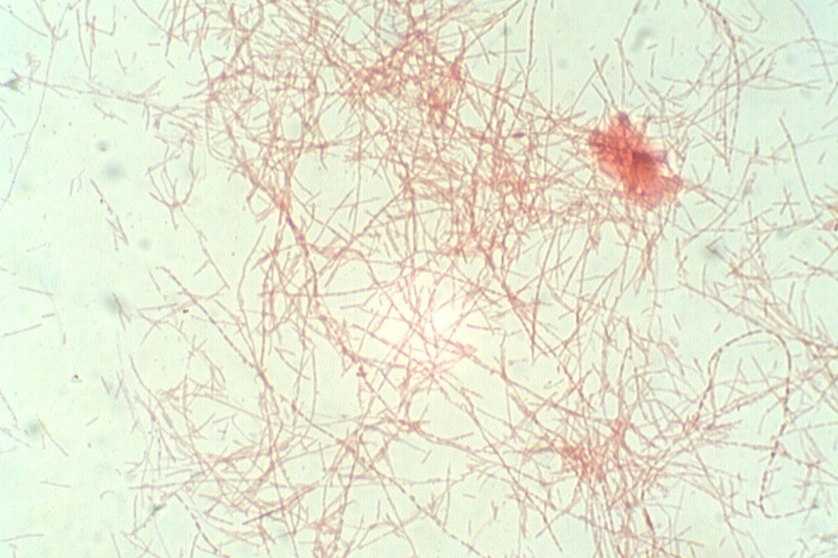 Fusobacterium nucleatum (Grampräparat, 1000fache Vergrößerung)