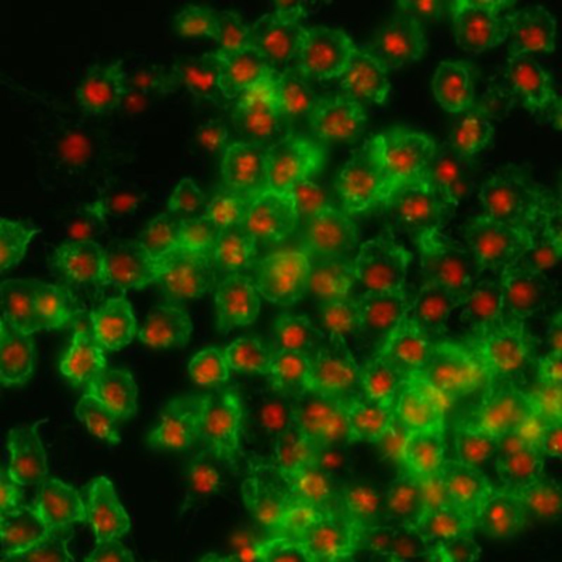 Drosophila melanogaster (Actin filament) - CIL:32137