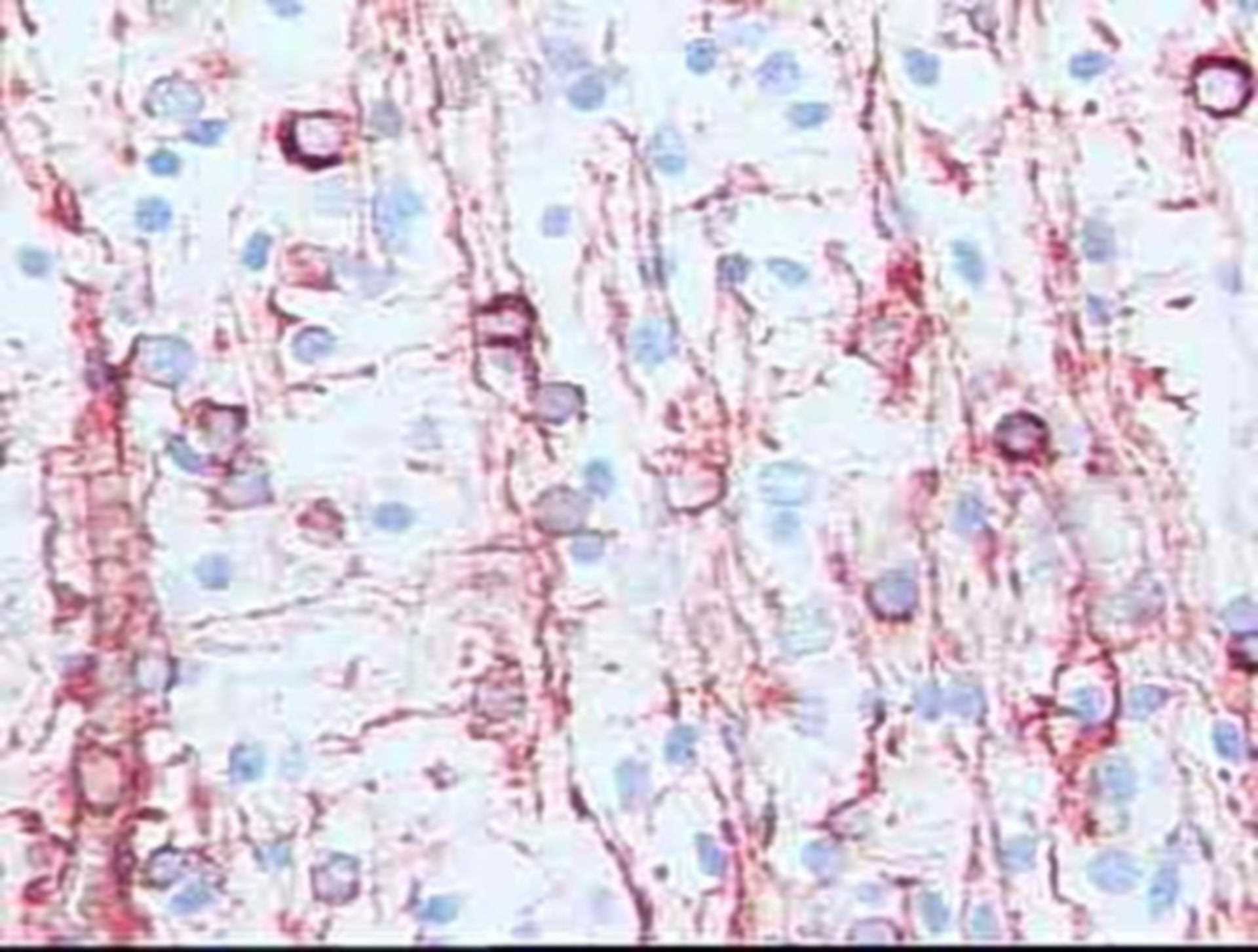 Oligodendroglia type 3